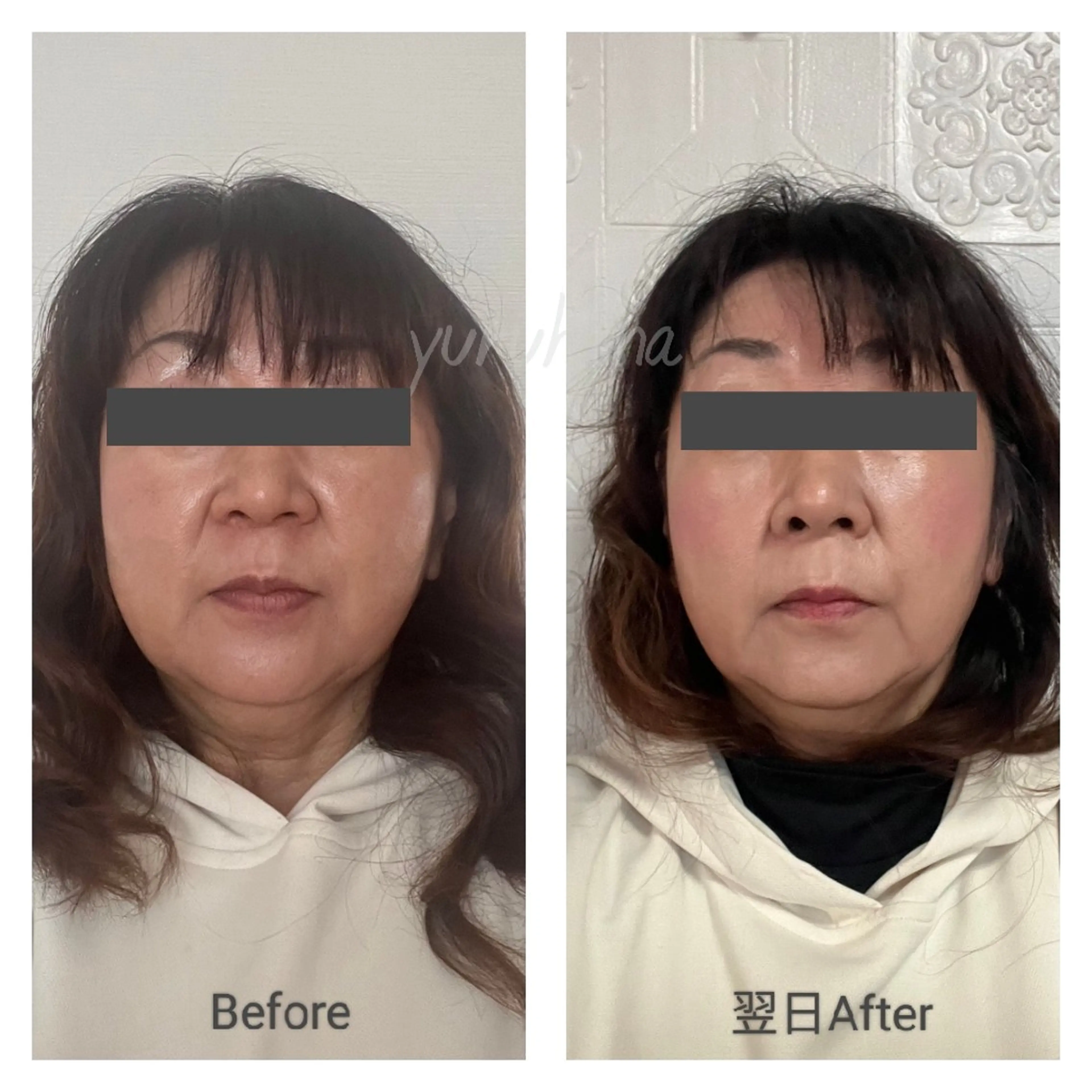 自然療法足つぼサロン yuruhanaのエステ・リラクイメージ