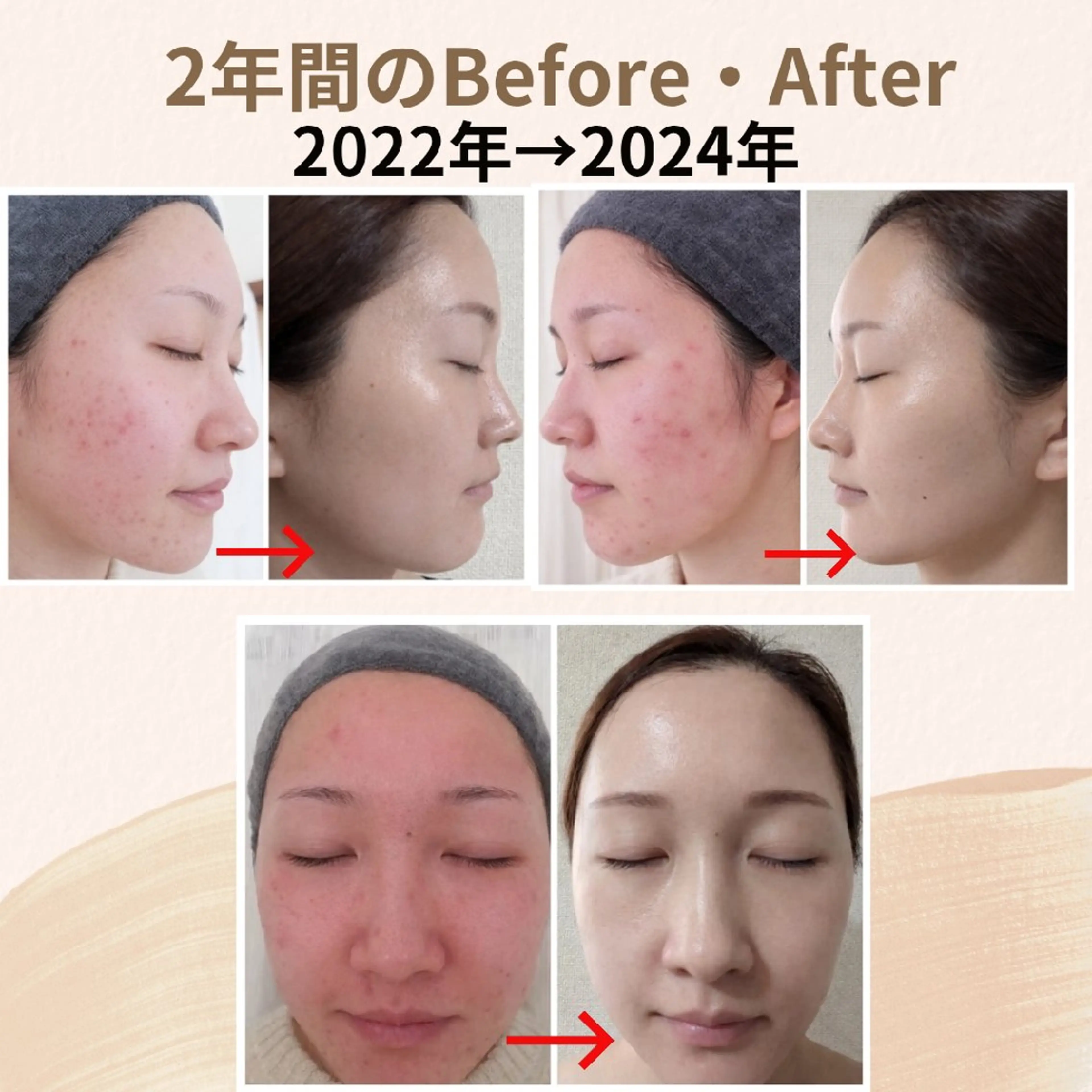 上尾Luce. あきやまのエステ・リラクイメージ