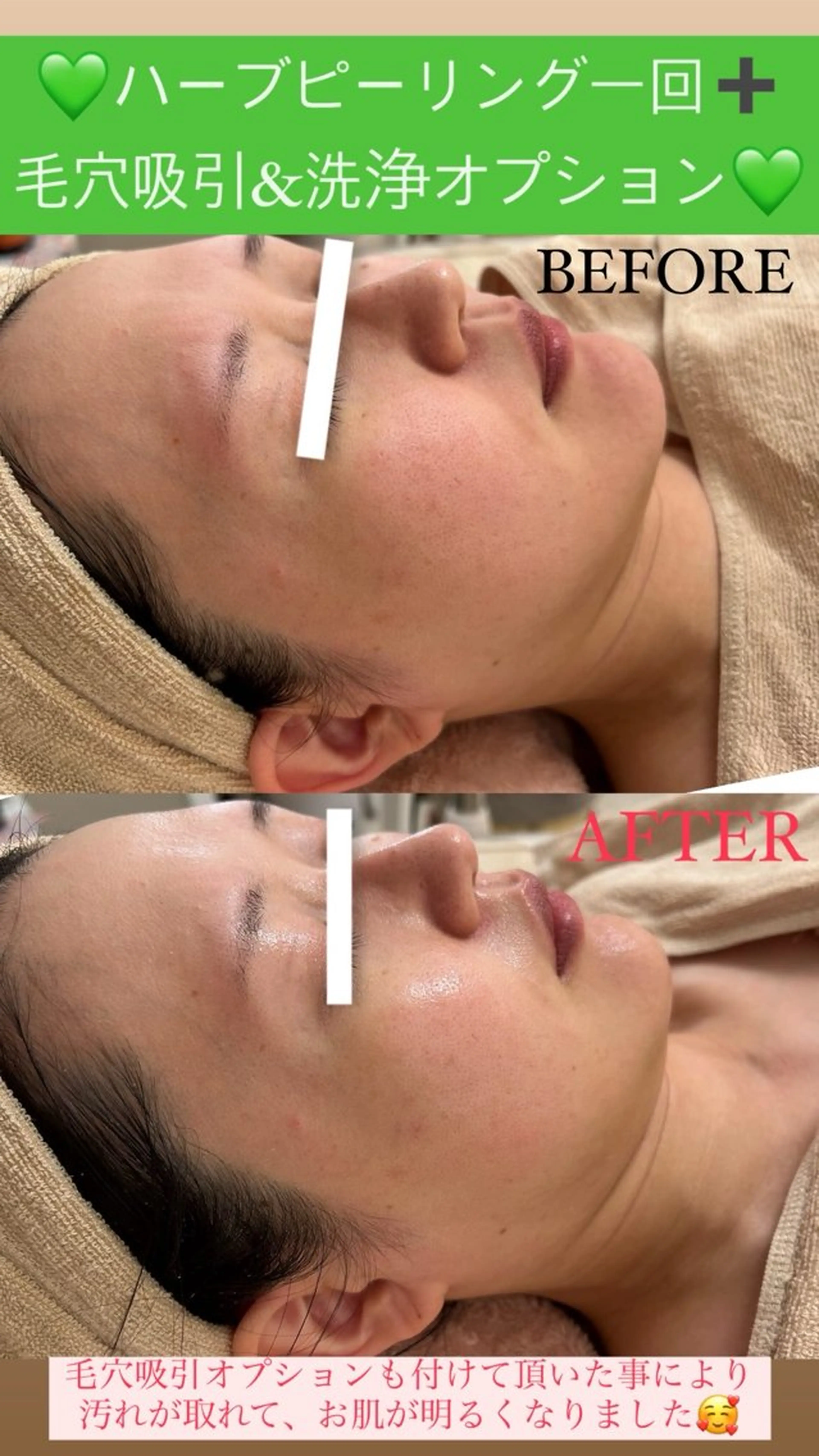 メンズ エステ Salon de Lino 御器所のエステ・リラクイメージ