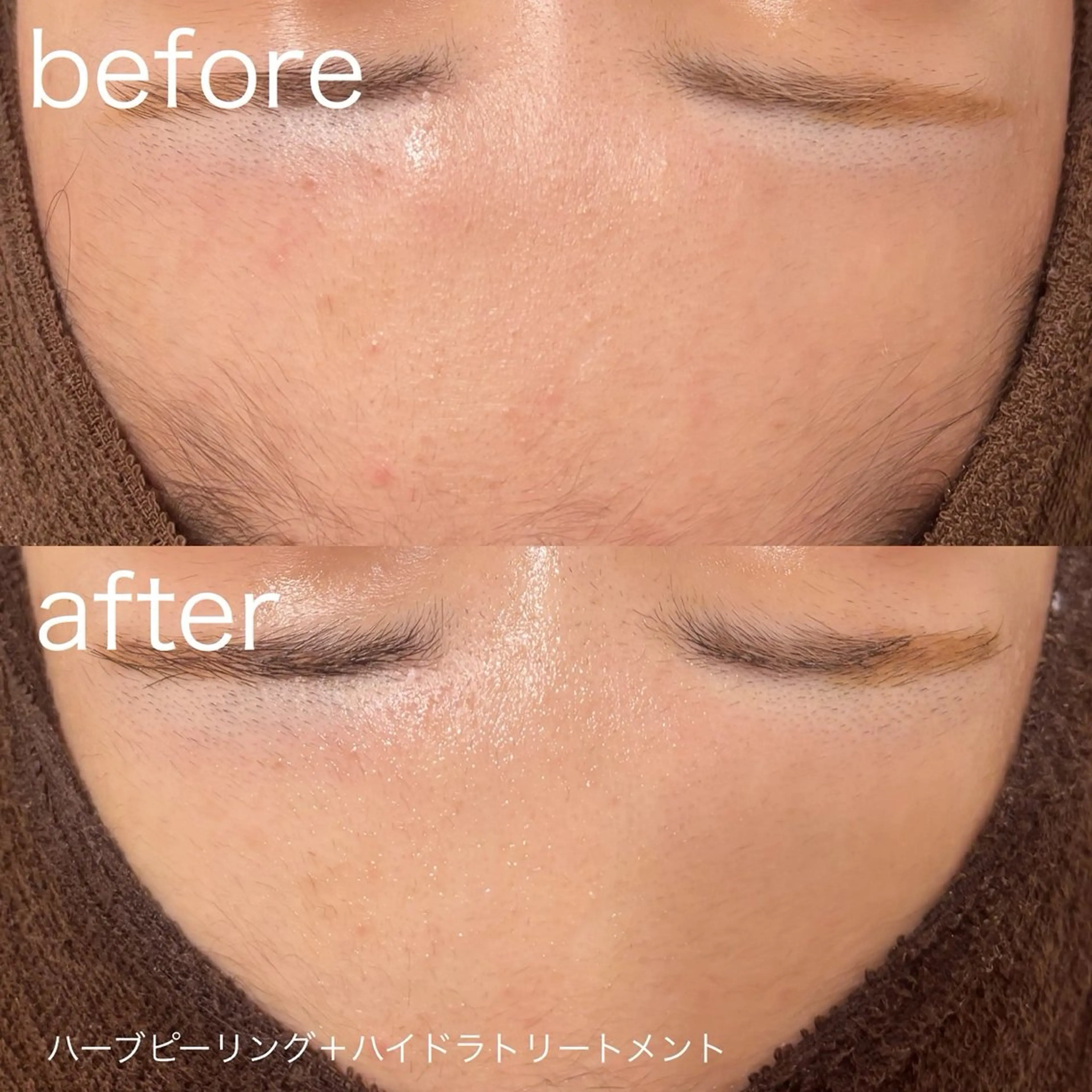 脱毛 lulularico Yuのエステ・リラクイメージ