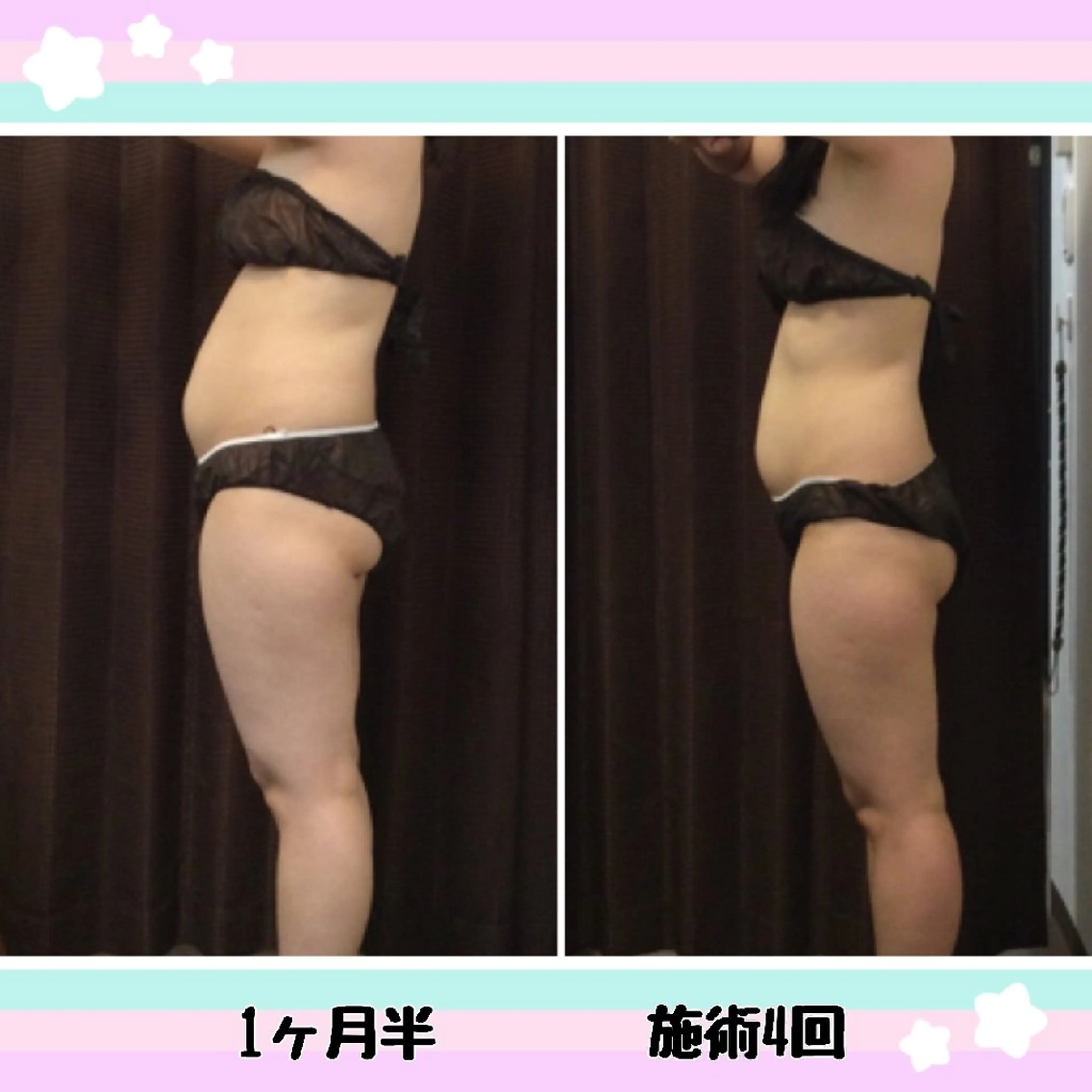 【美痩せ専門店】ビープロデュース豊田店所属・ビープロデュース 山下幸恵のエステ・リラクイメージ