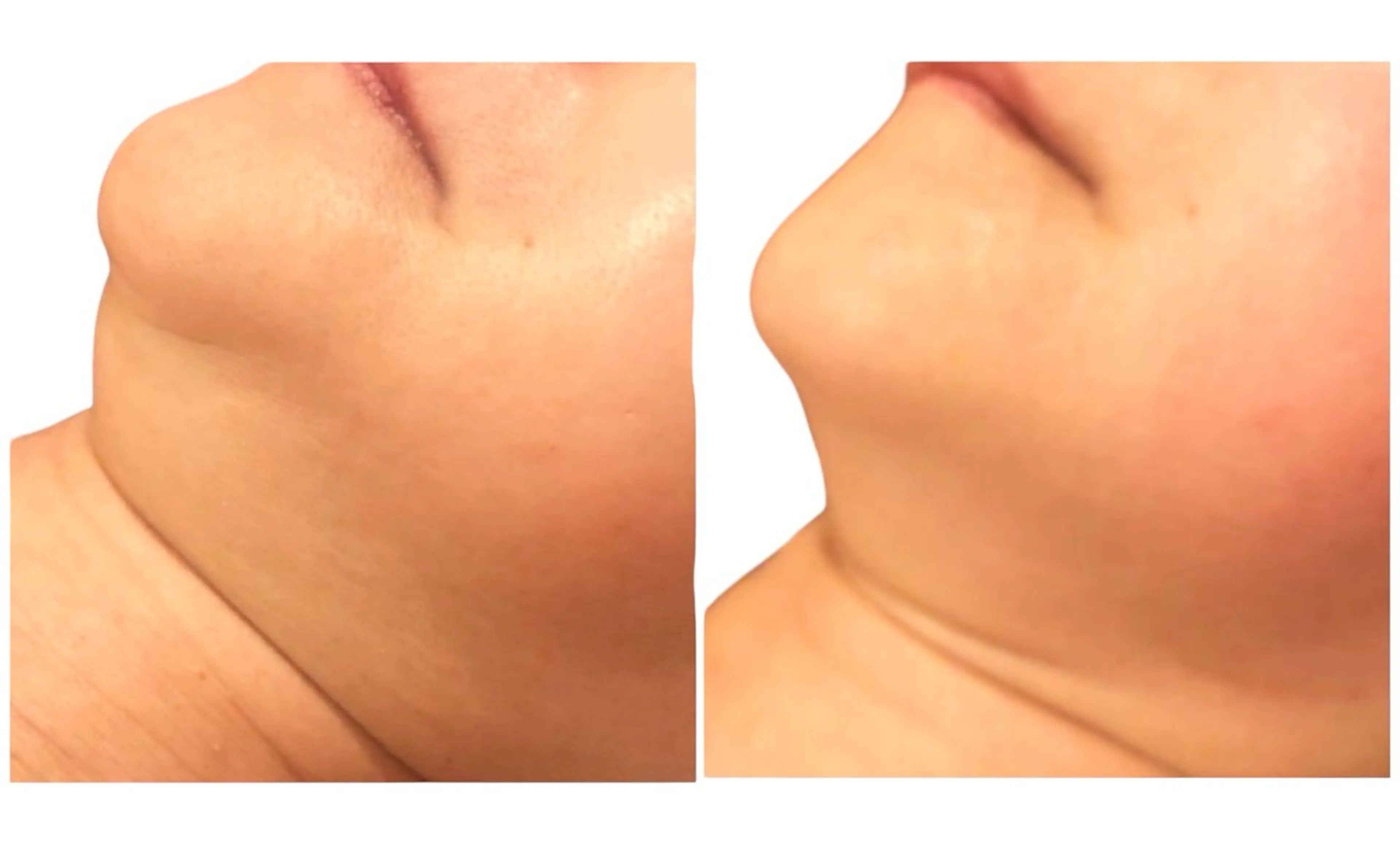 サロン美chill所属・骨格から変える痩身 サロン美chillのエステ・リラクイメージ