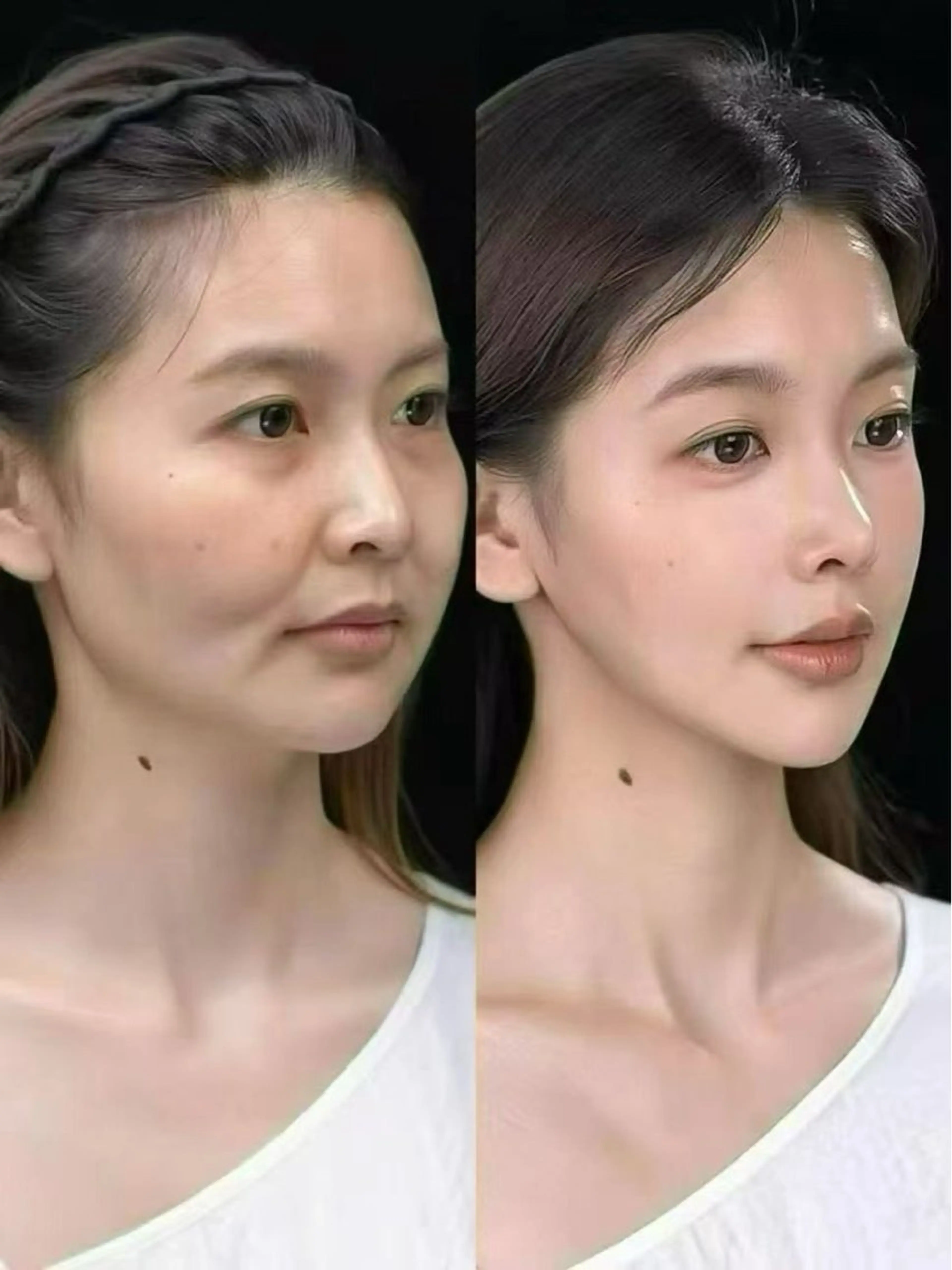 マツエク・マツパ エステ aliaハイフ&水光ジェットサロン所属・aliaハーブ水光店 エステティシャン募集のエステ・リラクイメージ