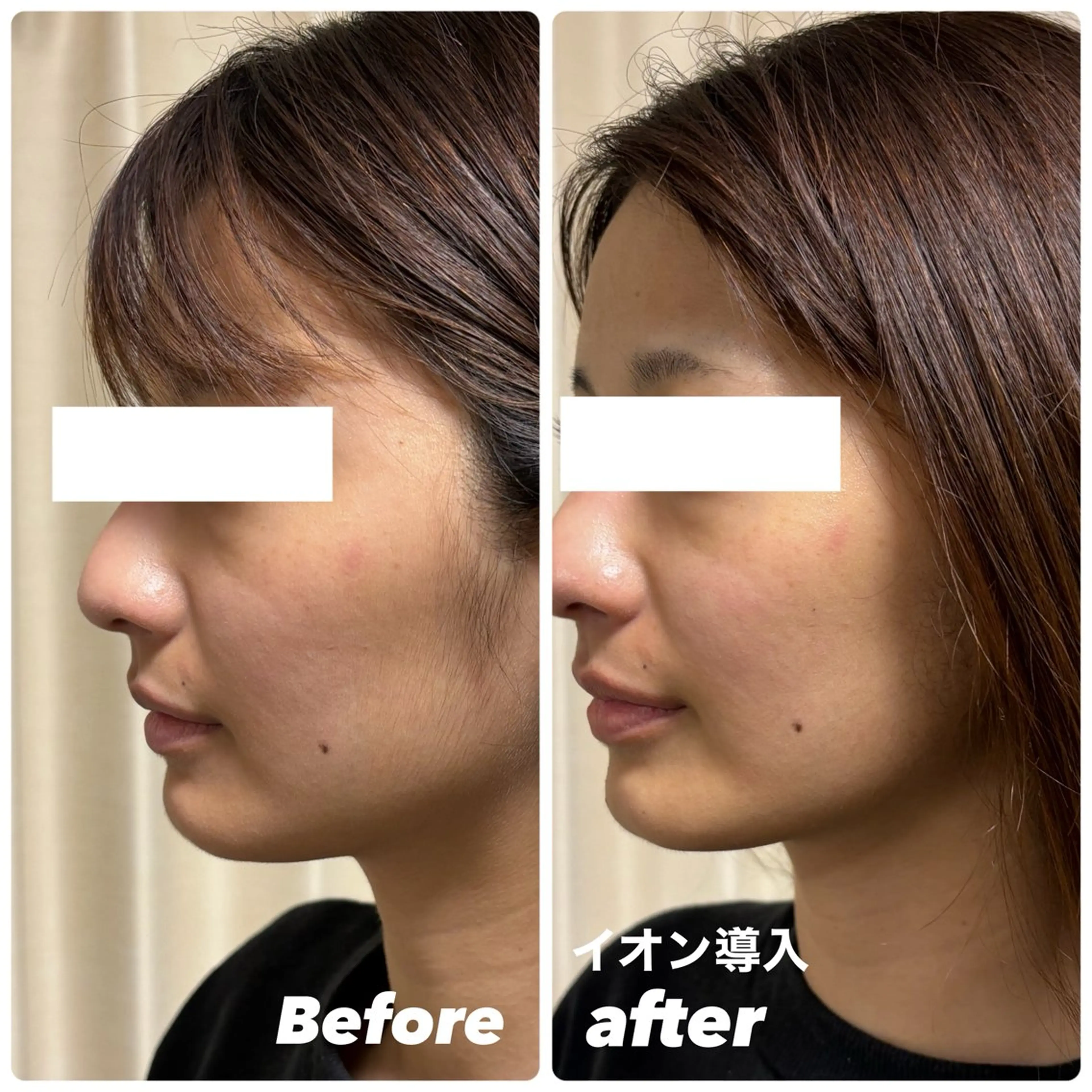 エステ 豊田 明里のエステ・リラクイメージ