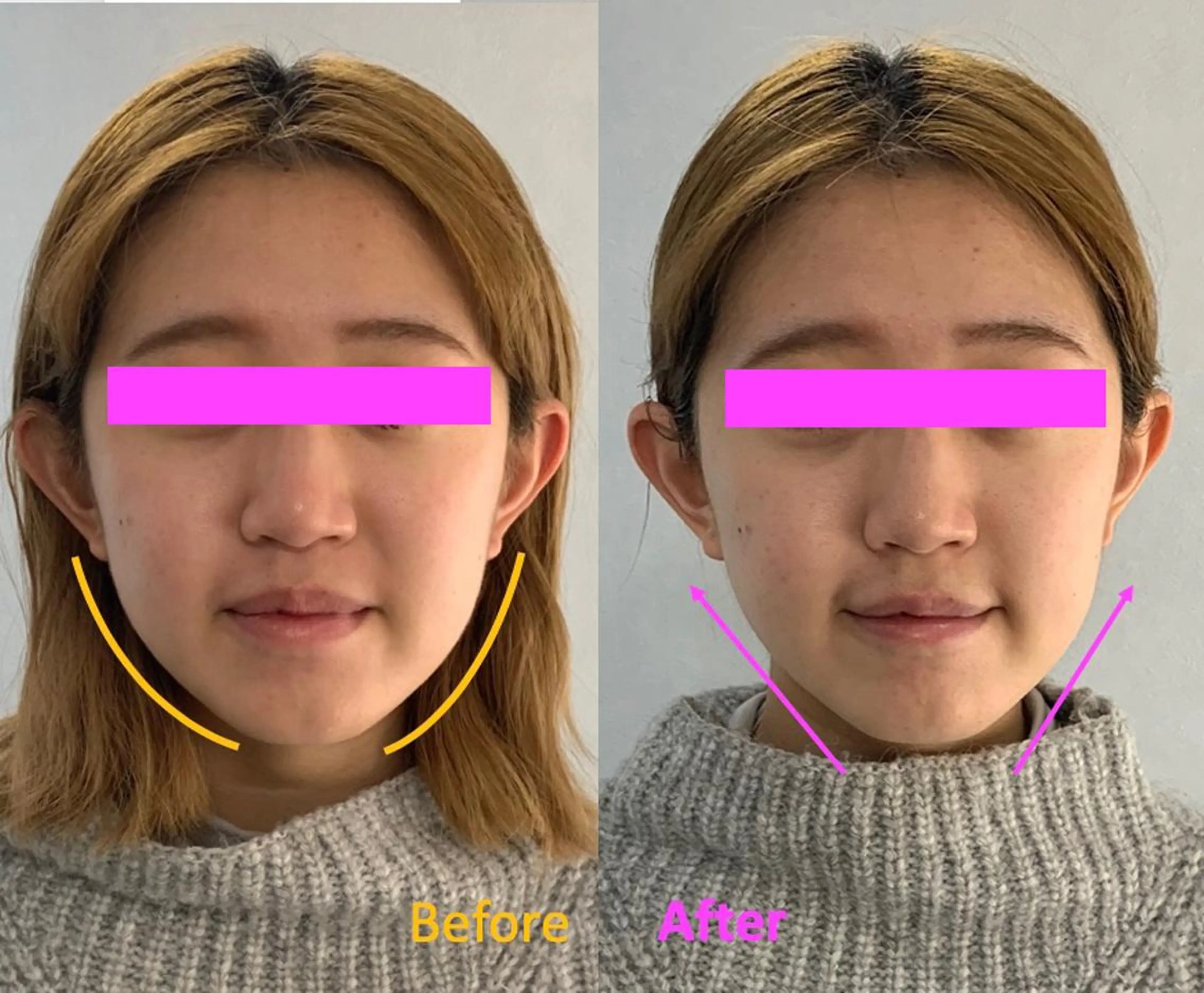 小顔美肌&痩身ｻﾛﾝ My Timeのエステ・リラクイメージ