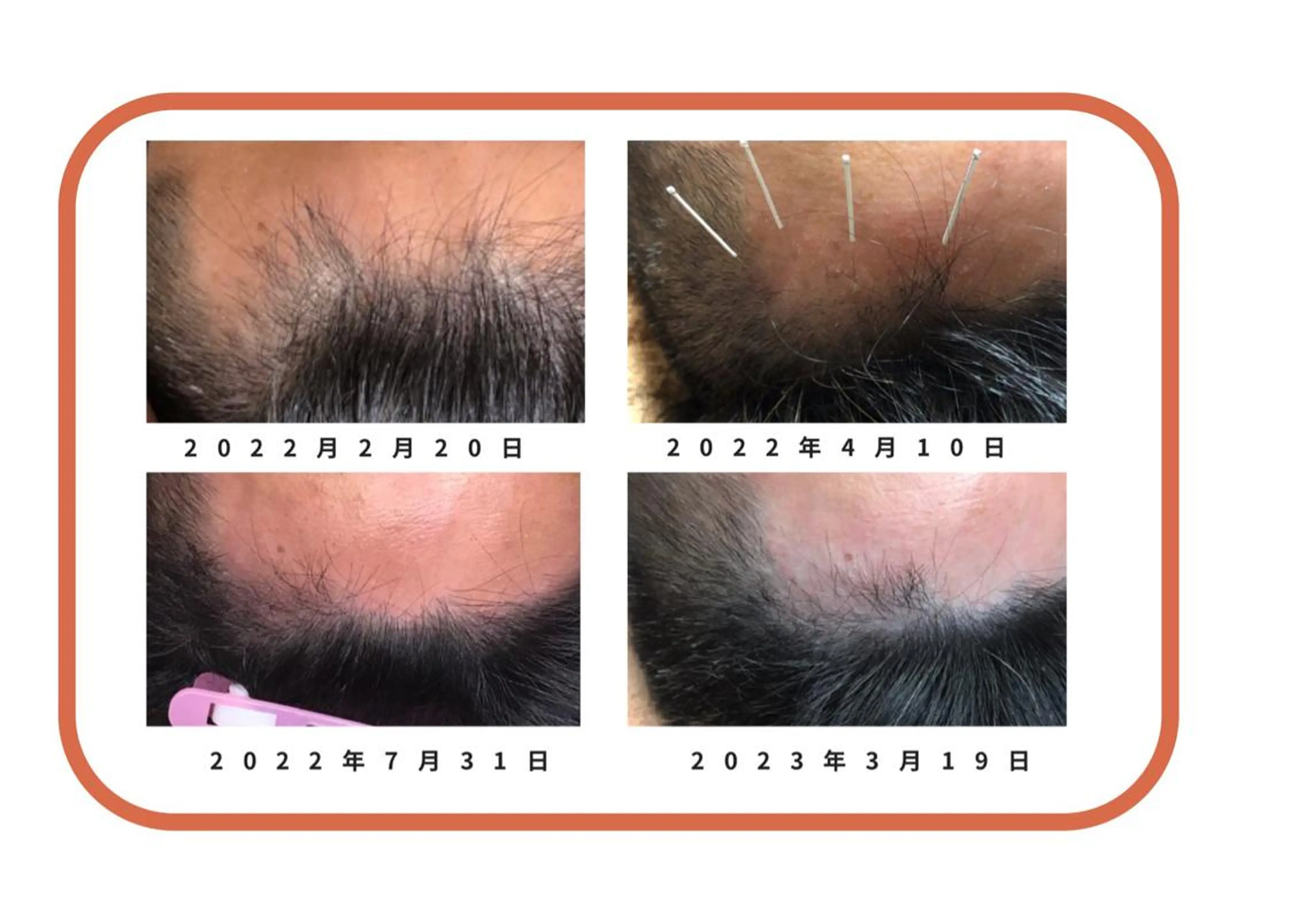 かすがい鍼灸院Re.heart所属・かすがい鍼灸院 Re.heartのエステ・リラクイメージ