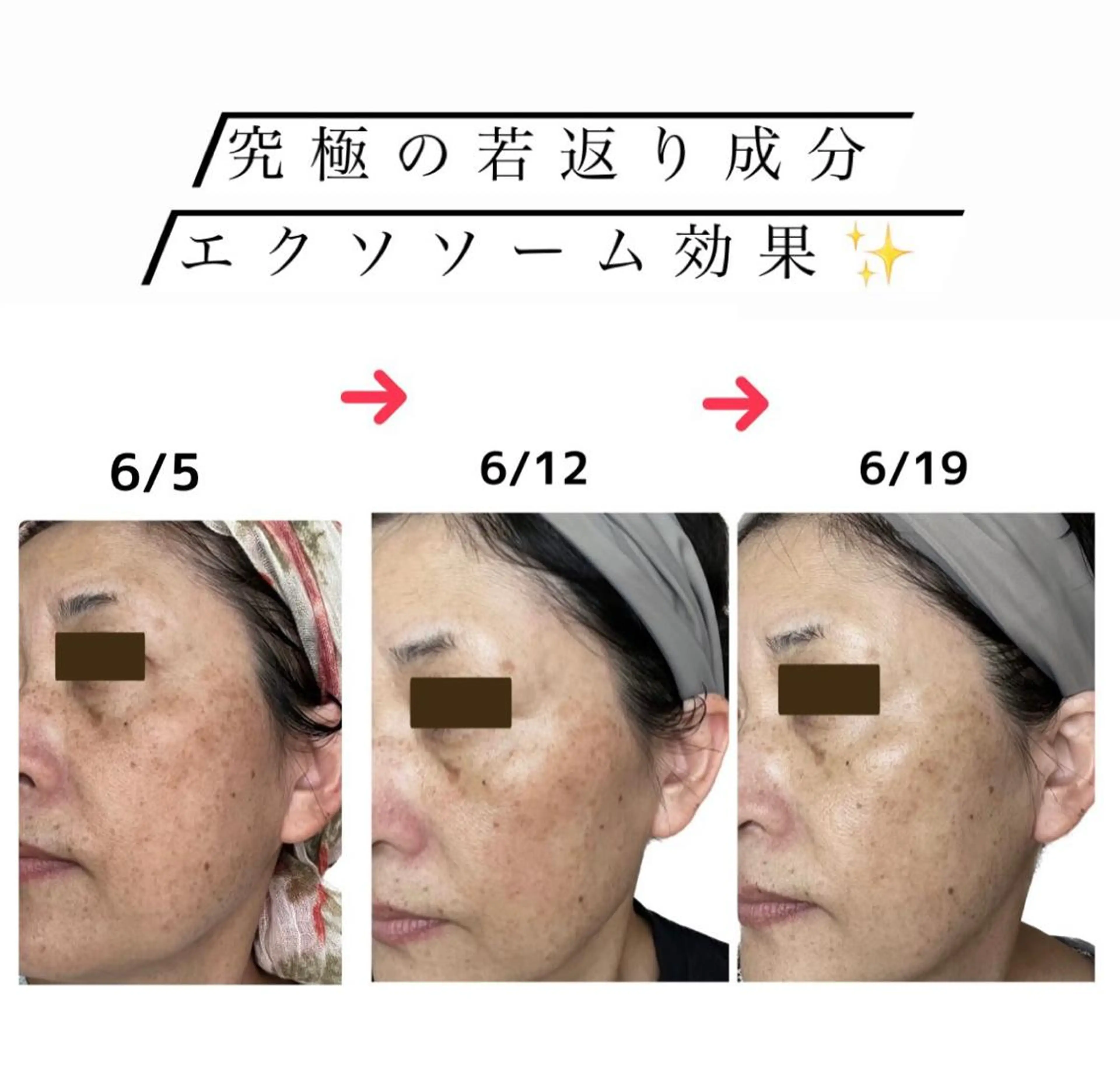 stella所属・stella都度払い 痩身小顔まつげパーマのマツエク・マツパデザイン