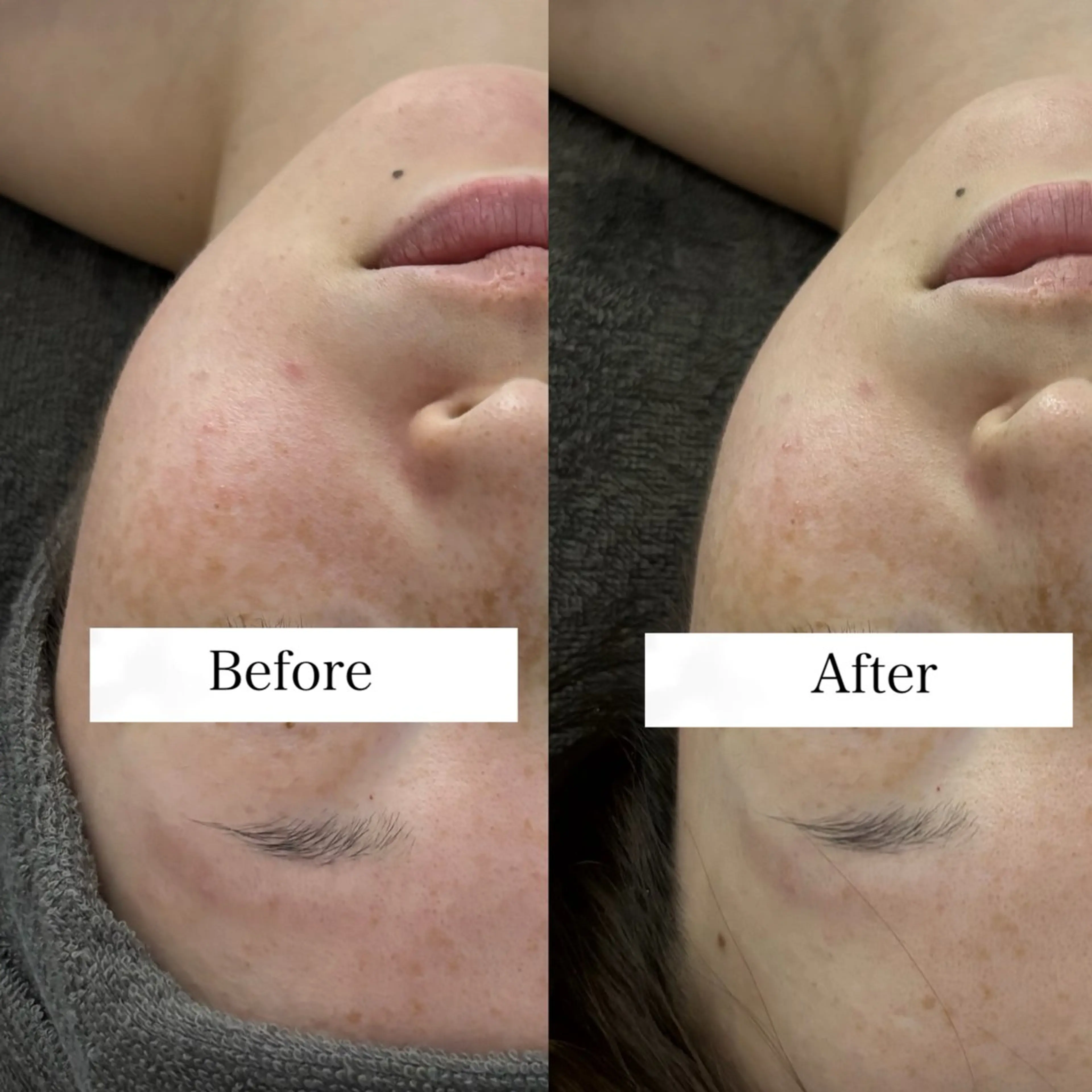 エステ リラク Linoas所属・kogao&head Linoasのその他イメージ