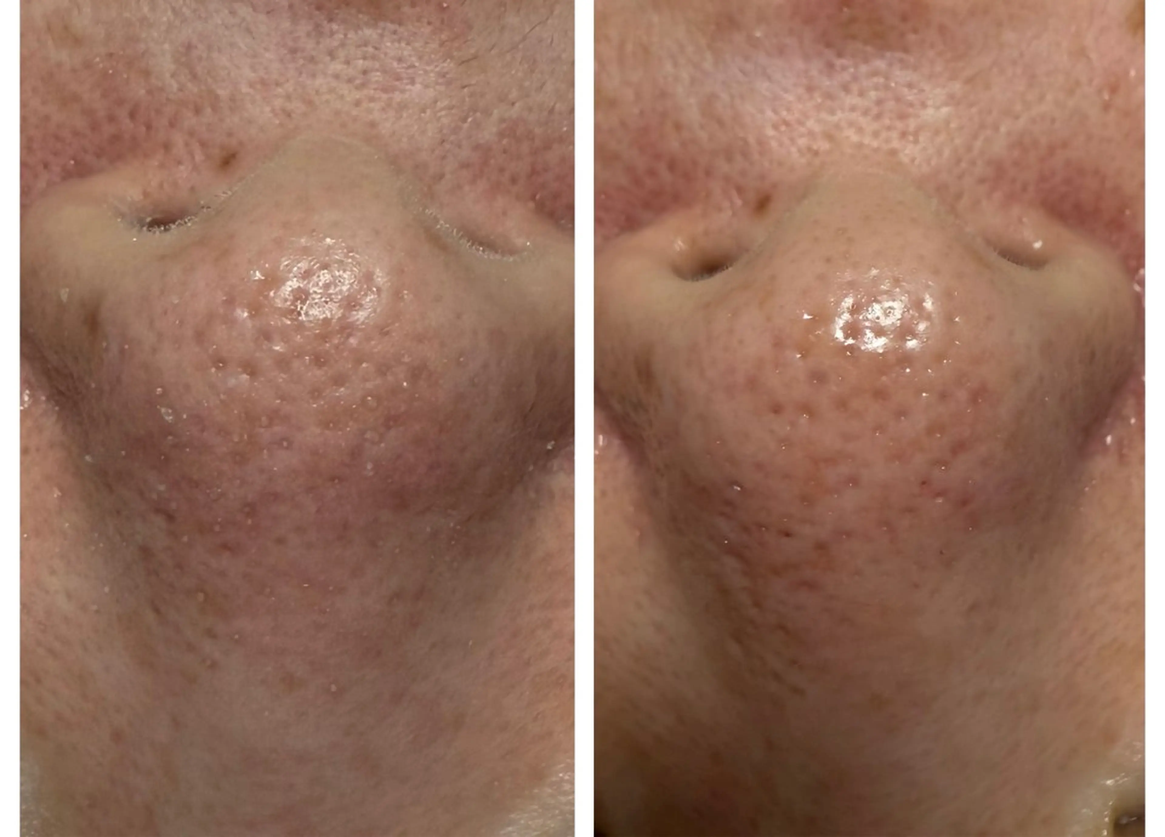 エステ LUCIALL  ルシアル所属・児玉 愛由美のエステ・リラクイメージ