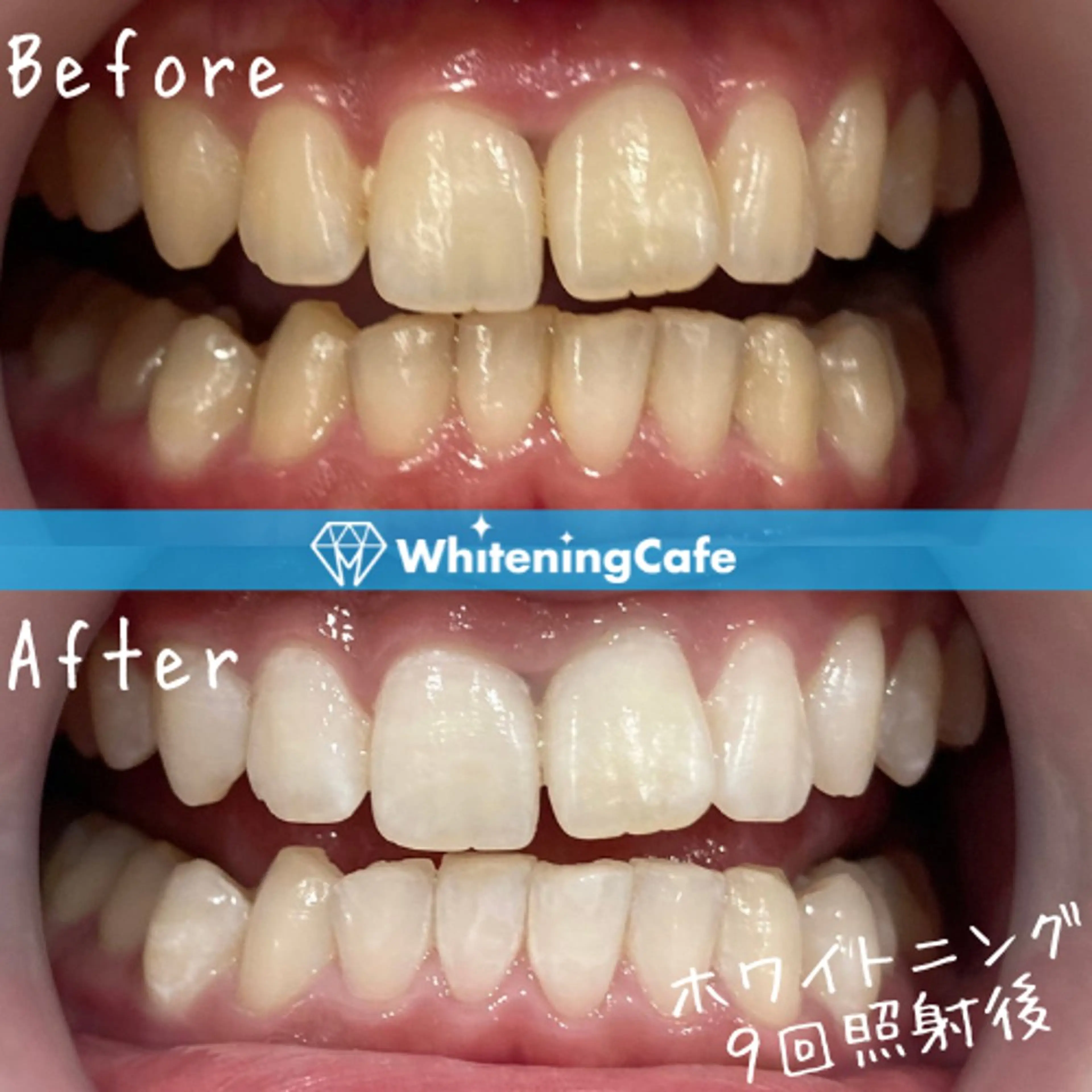 ホワイトニングカフェ神戸元町店所属・ホワイトニングカフェ 神戸元町店のエステ・リラクイメージ