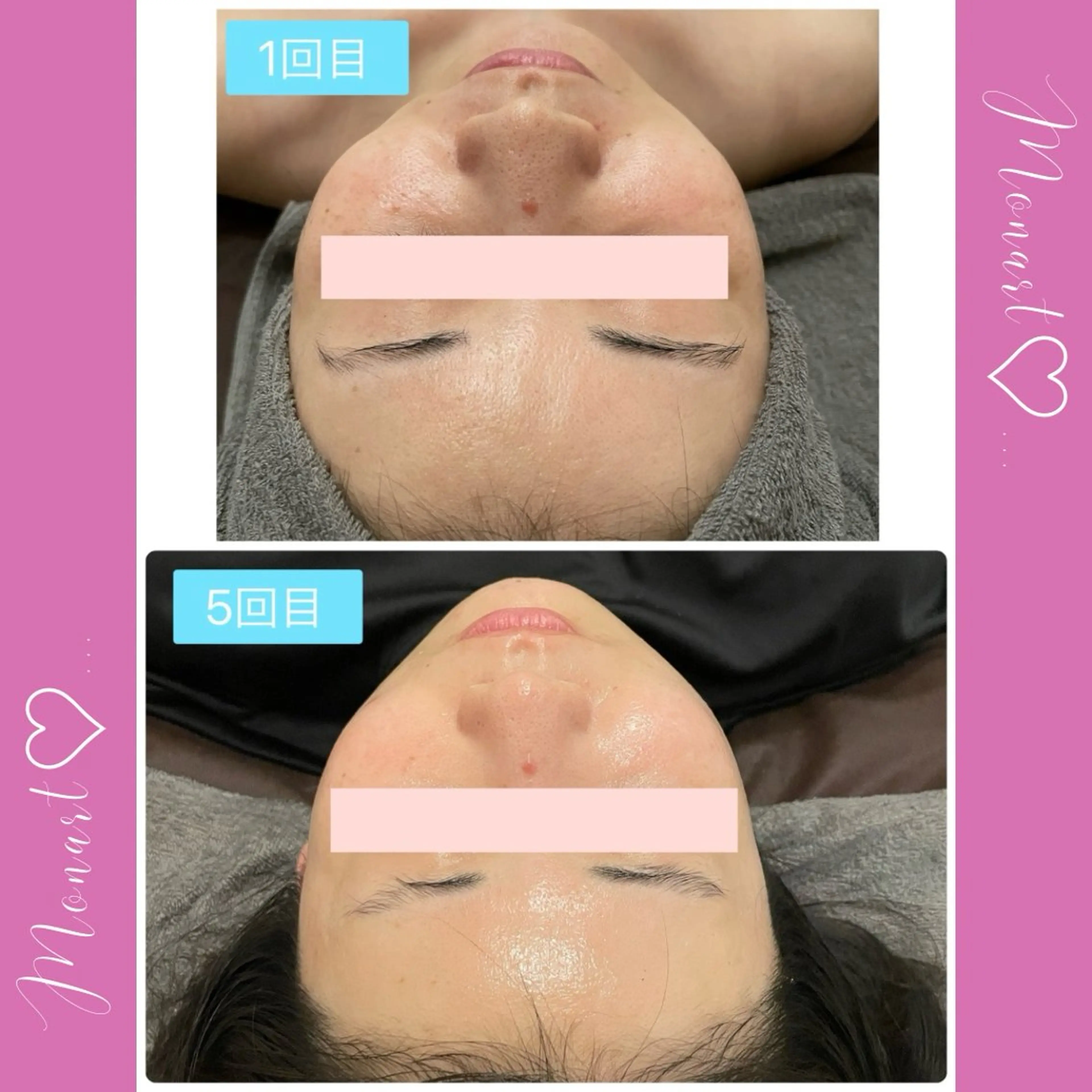 Monart -deux-のエステ・リラクイメージ