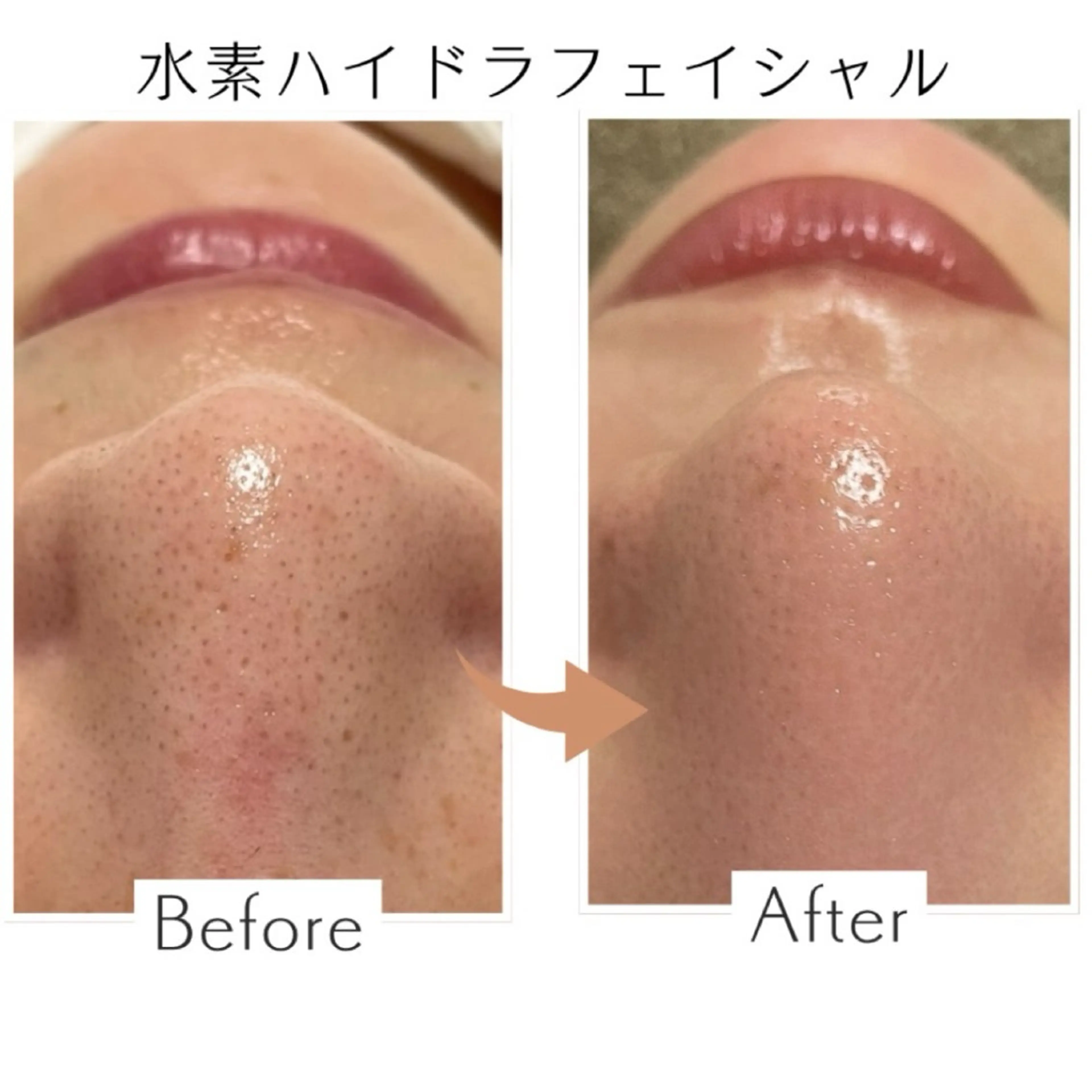 エステ リラク プライベートサロン Belle（ベル）のエステ・リラクイメージ