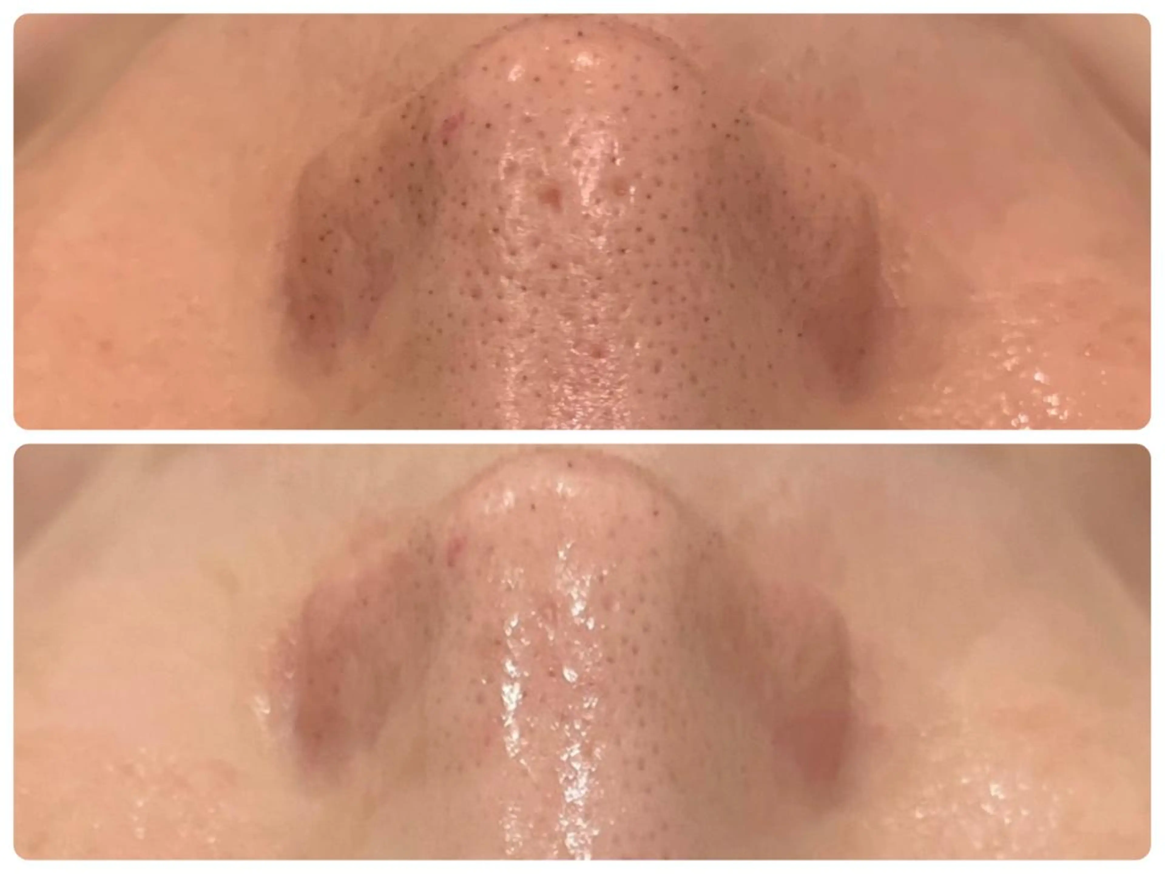 エステ リラク 通うほど変わる本格 エステ心斎橋REVIのエステ・リラクイメージ