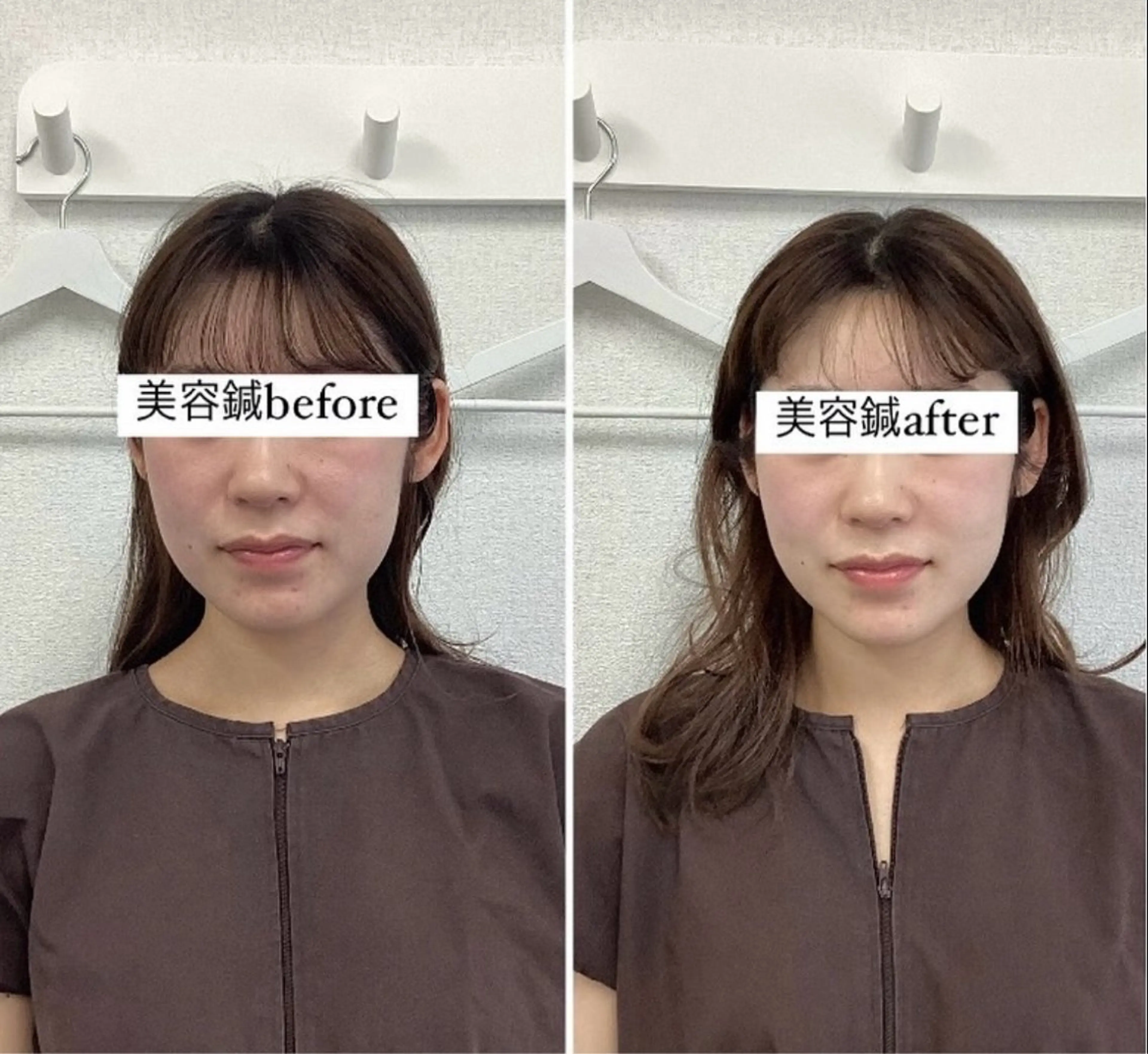 エステ リラク hari salon de off　美容鍼灸×小顔整体【ハリサロンドオフ】所属・美容鍼灸×小顔整体♡ ハリサロンドオフ堺東のエステ・リラクイメージ