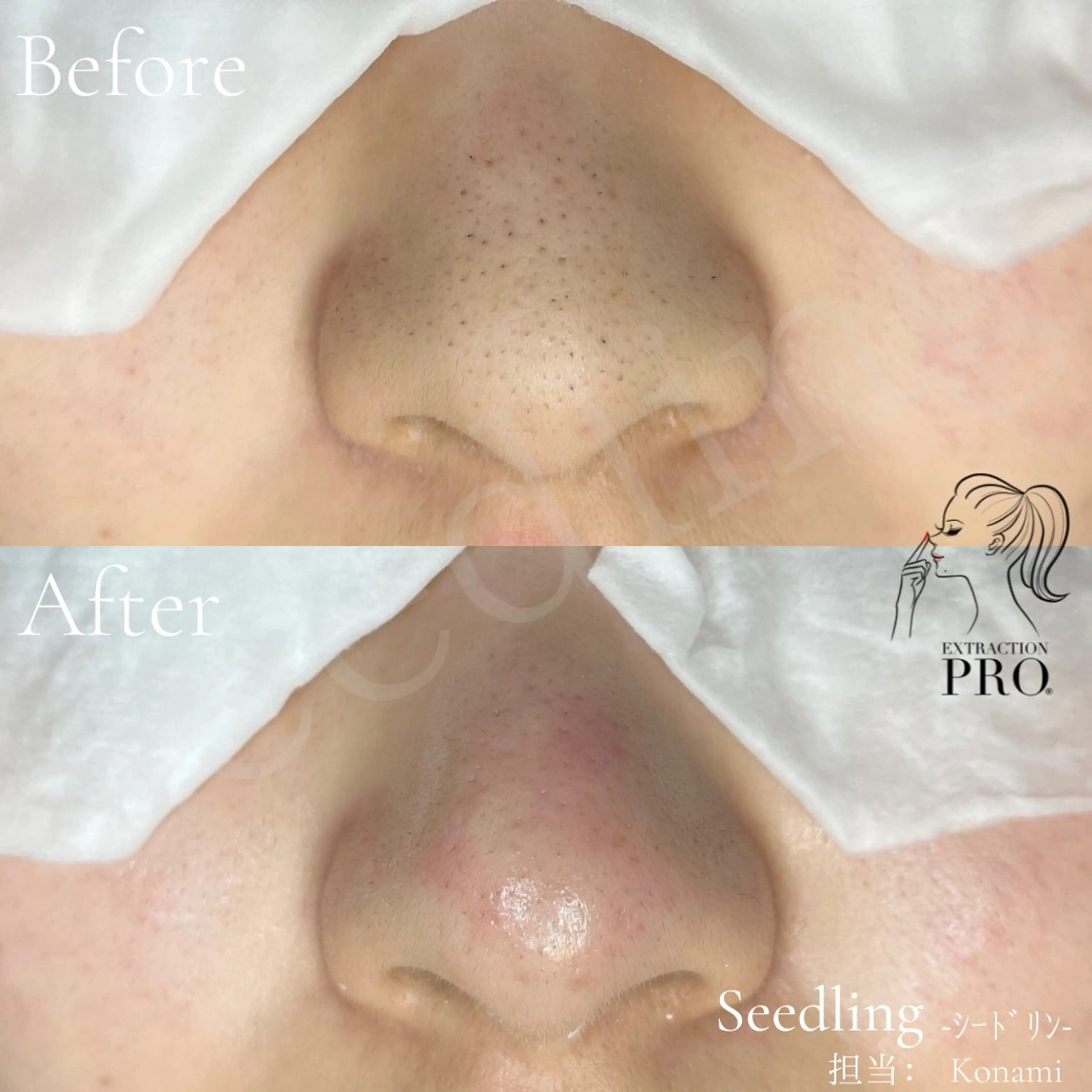 エステ シードリン 府内店 小波のエステ・リラクイメージ