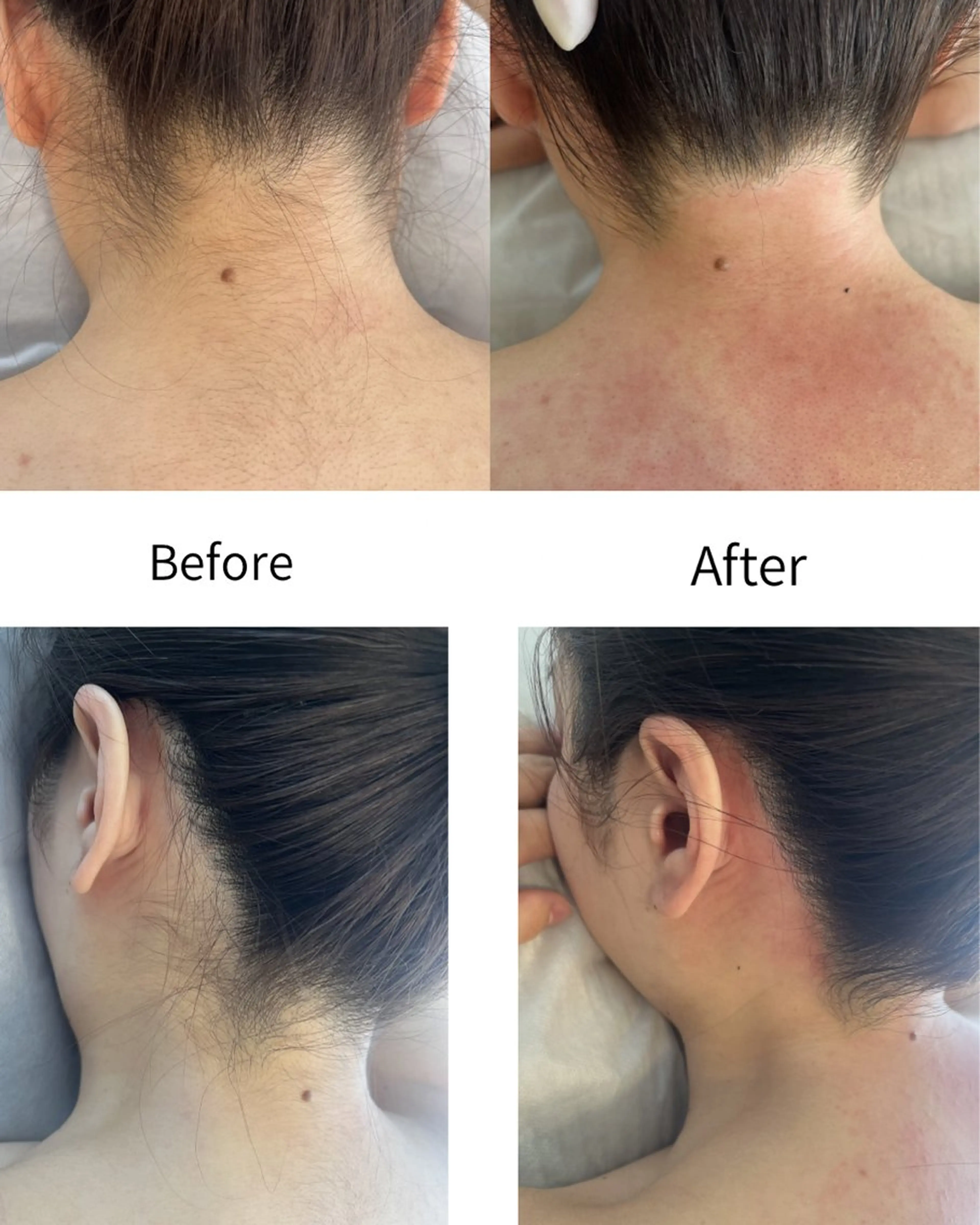 脱毛 MASAMI マサミのエステ・リラクイメージ