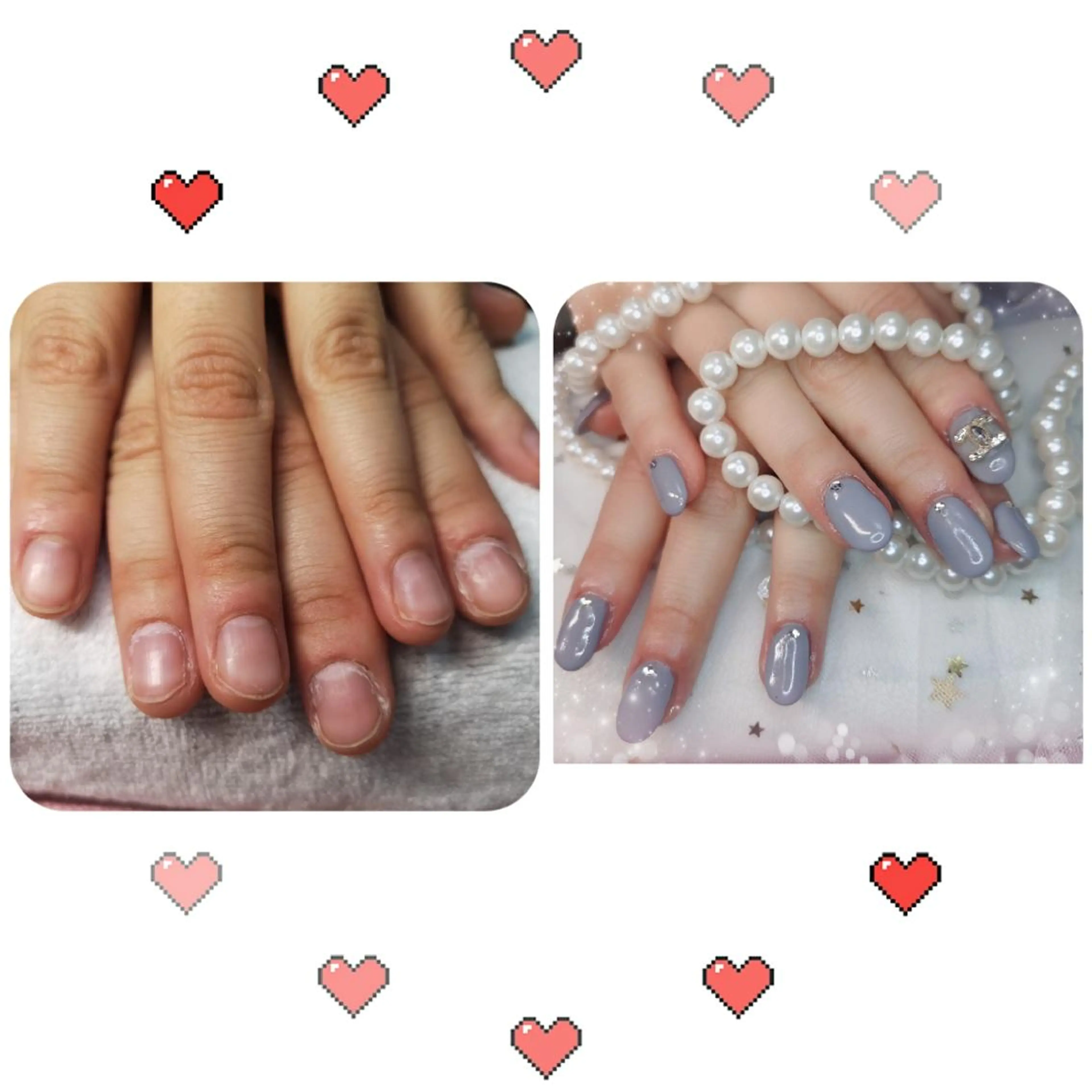 ショート ネイル ネイリストゆか💅 長さだし、深爪矯正のネイルデザイン