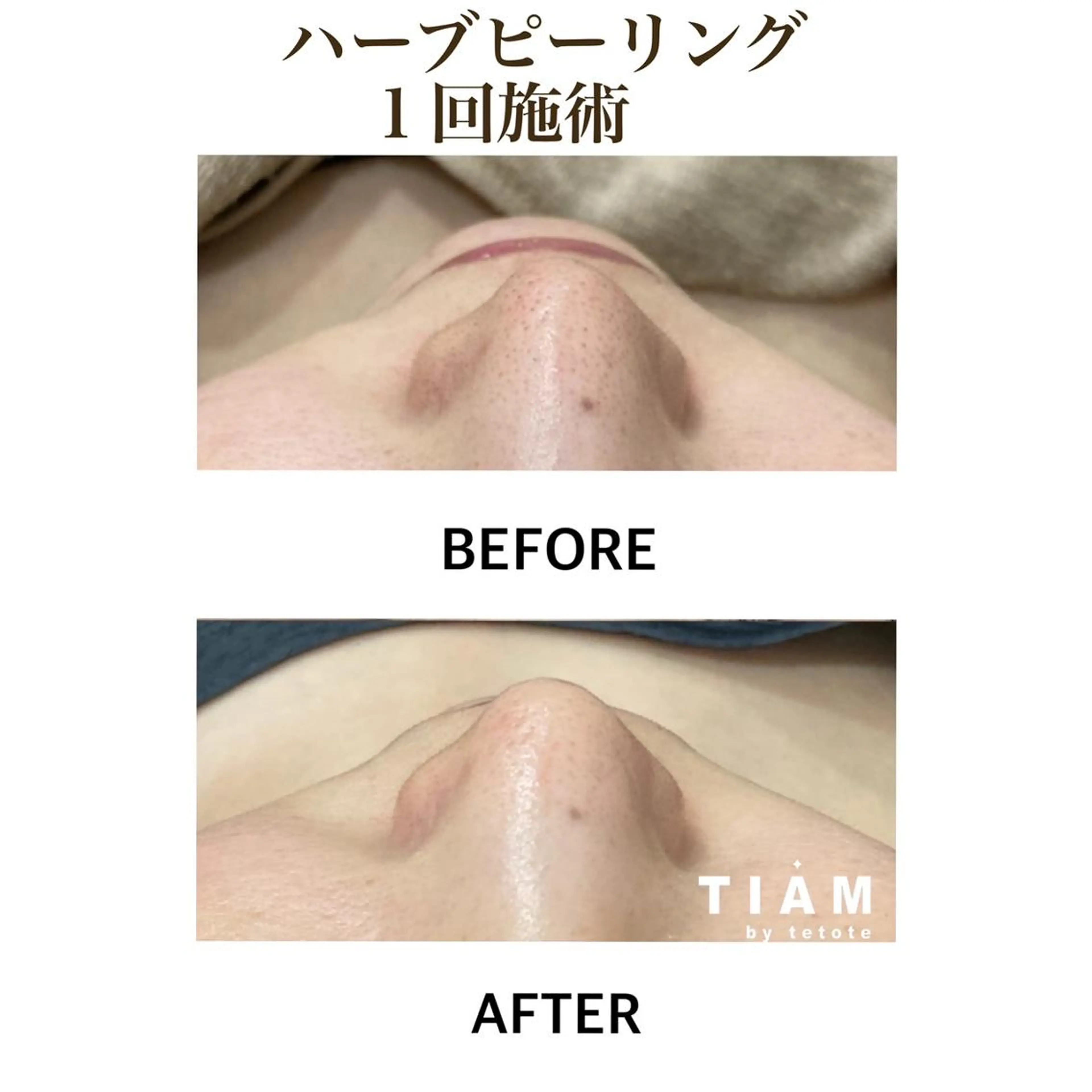 エステ 美肌サロンTIAM by tetoteのエステ・リラクイメージ