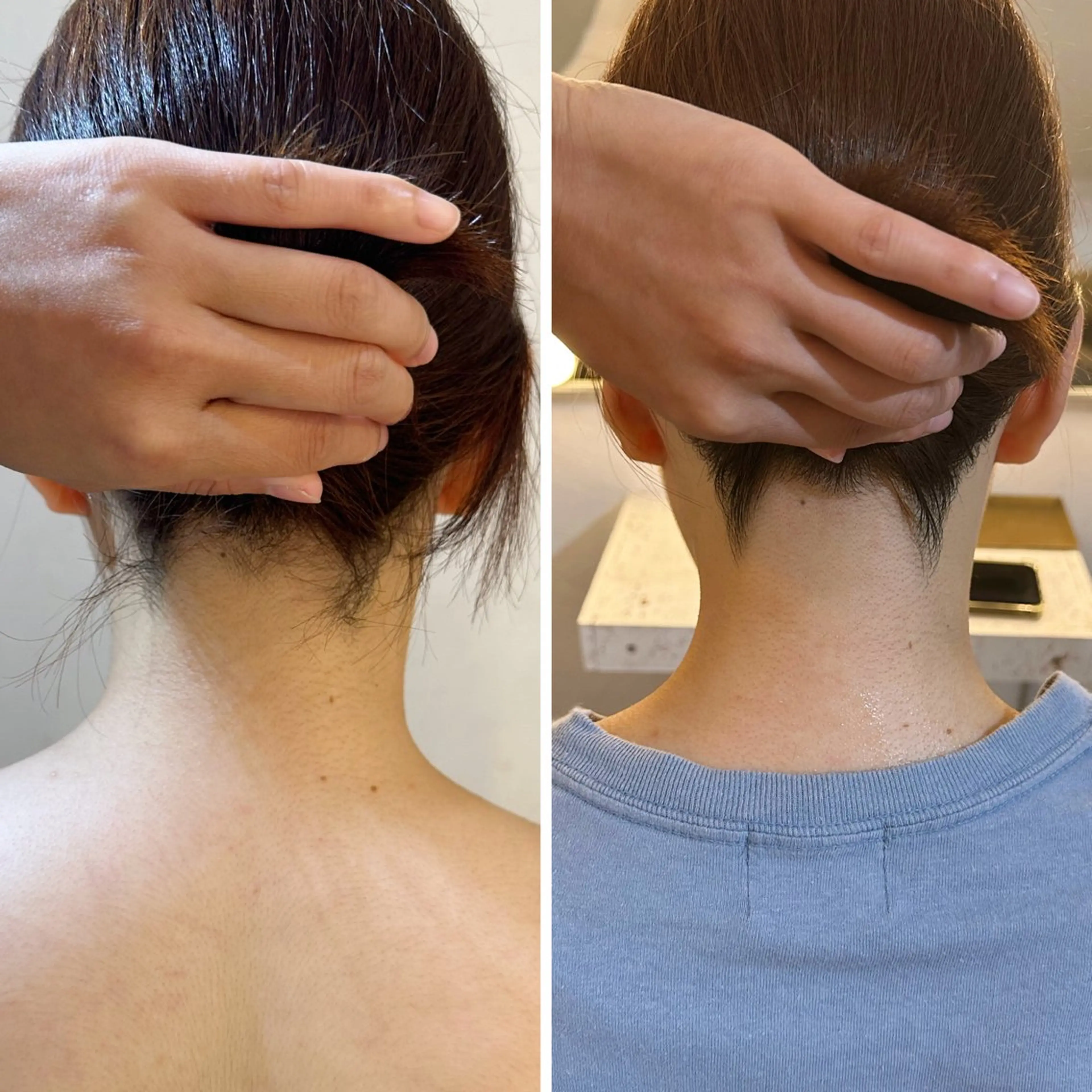 脱毛 うなじ脱毛/美肌脱毛 LABELのエステ・リラクイメージ