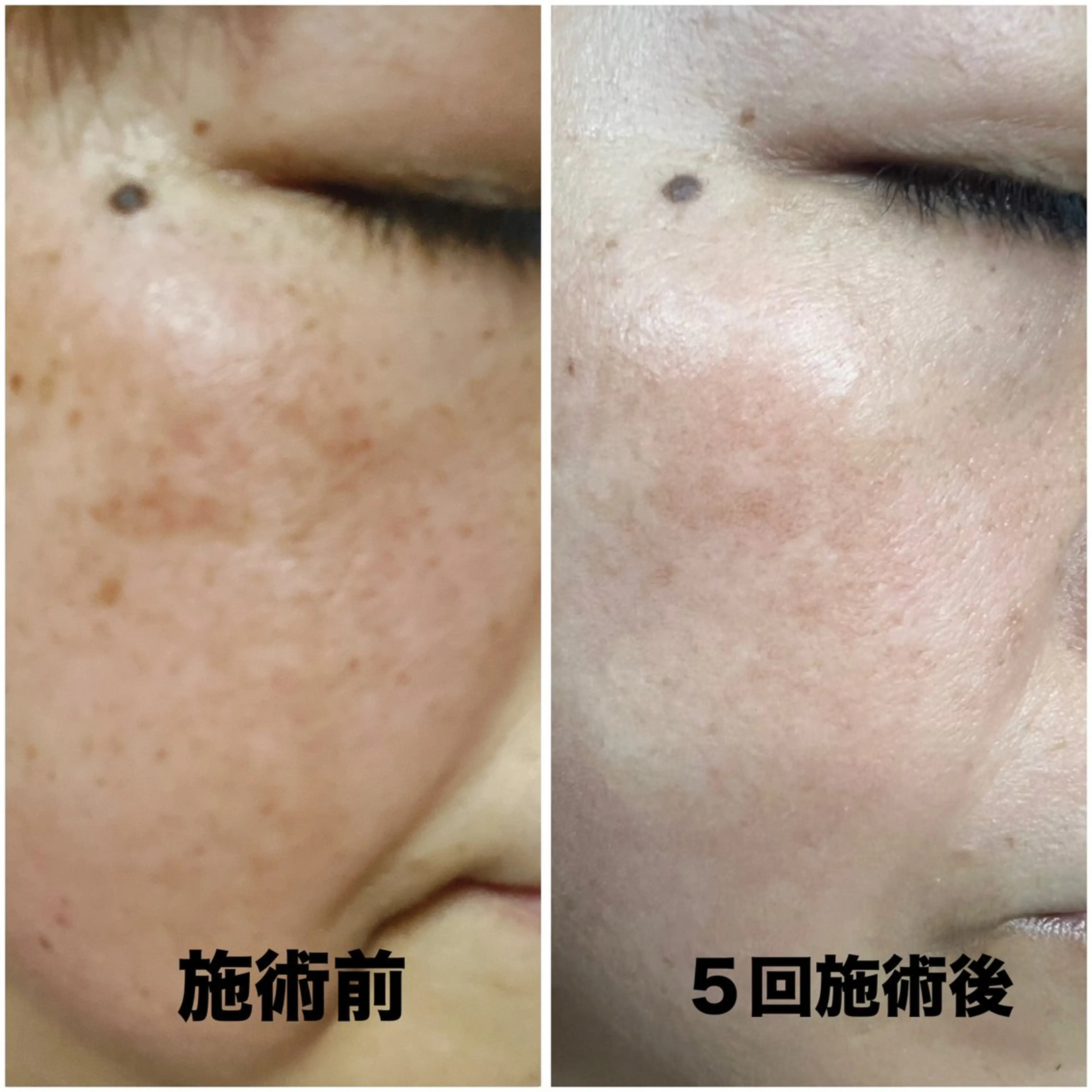 スリーエスプラス内　美肌サロンEme所属・希映 -kieのエステ・リラクイメージ