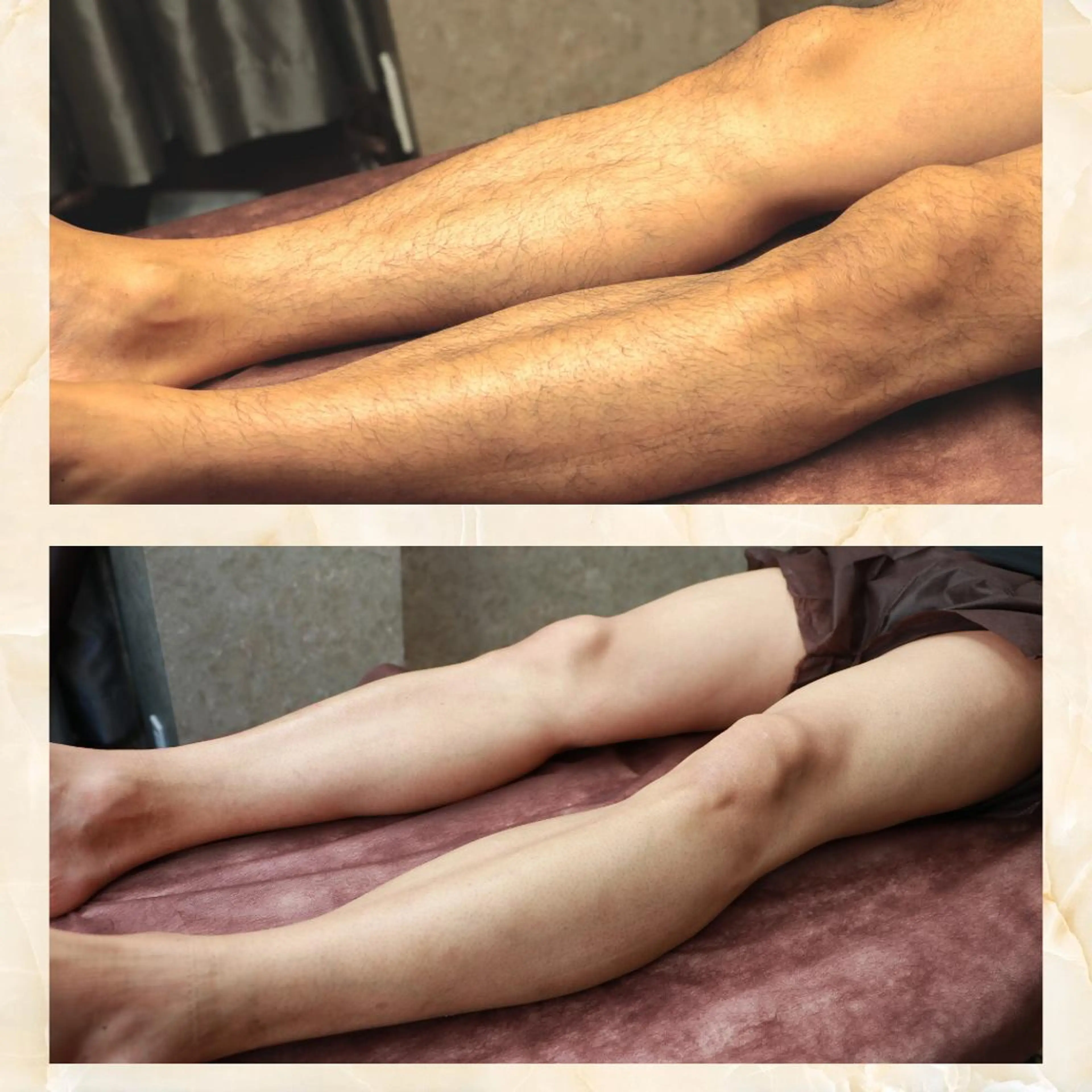 メンズ 男女同額脱毛エステ salonLEPIAのエステ・リラクイメージ