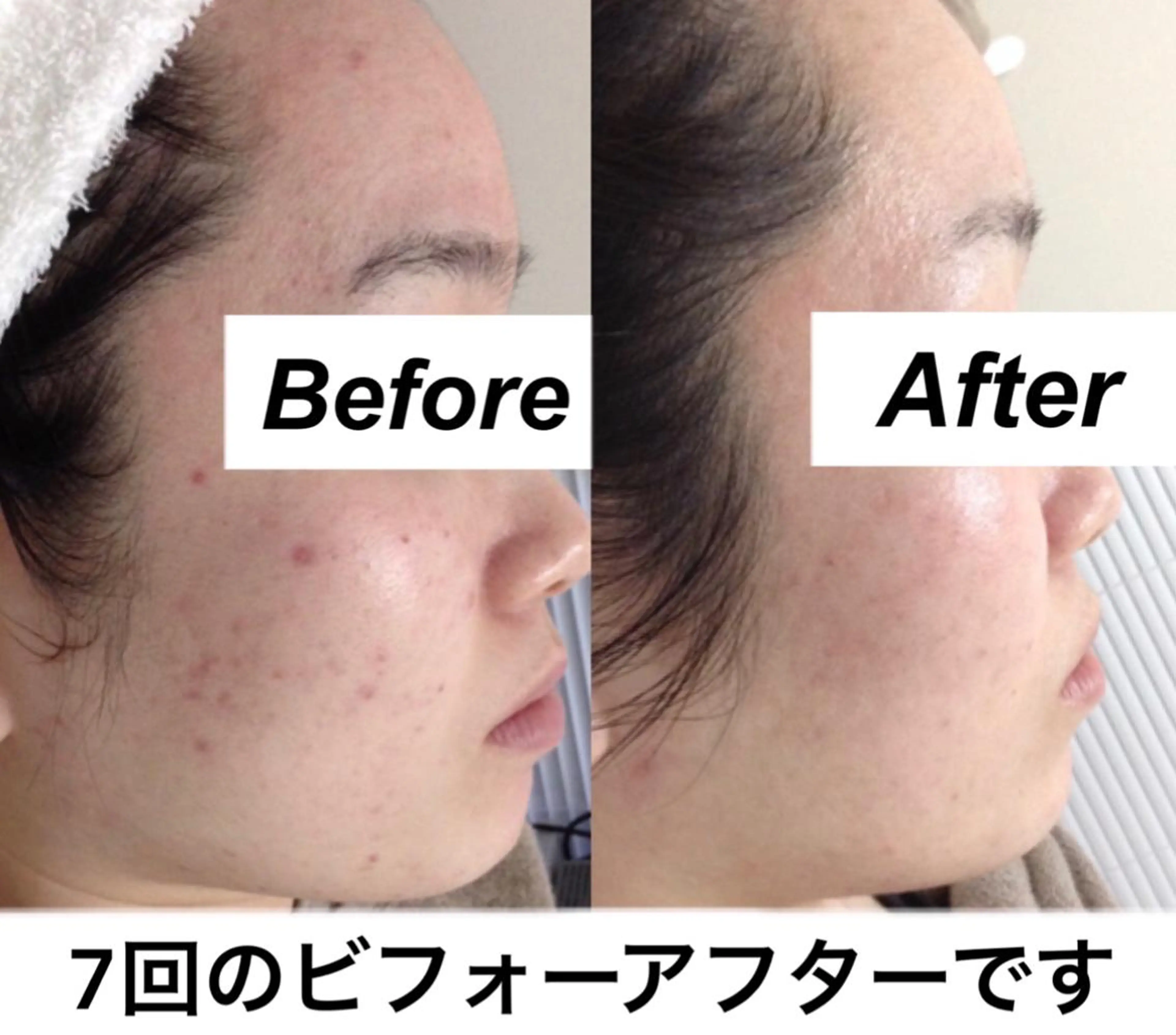 エステ リラク 都度払い肌質改善 &脱毛Blancheのエステ・リラクイメージ