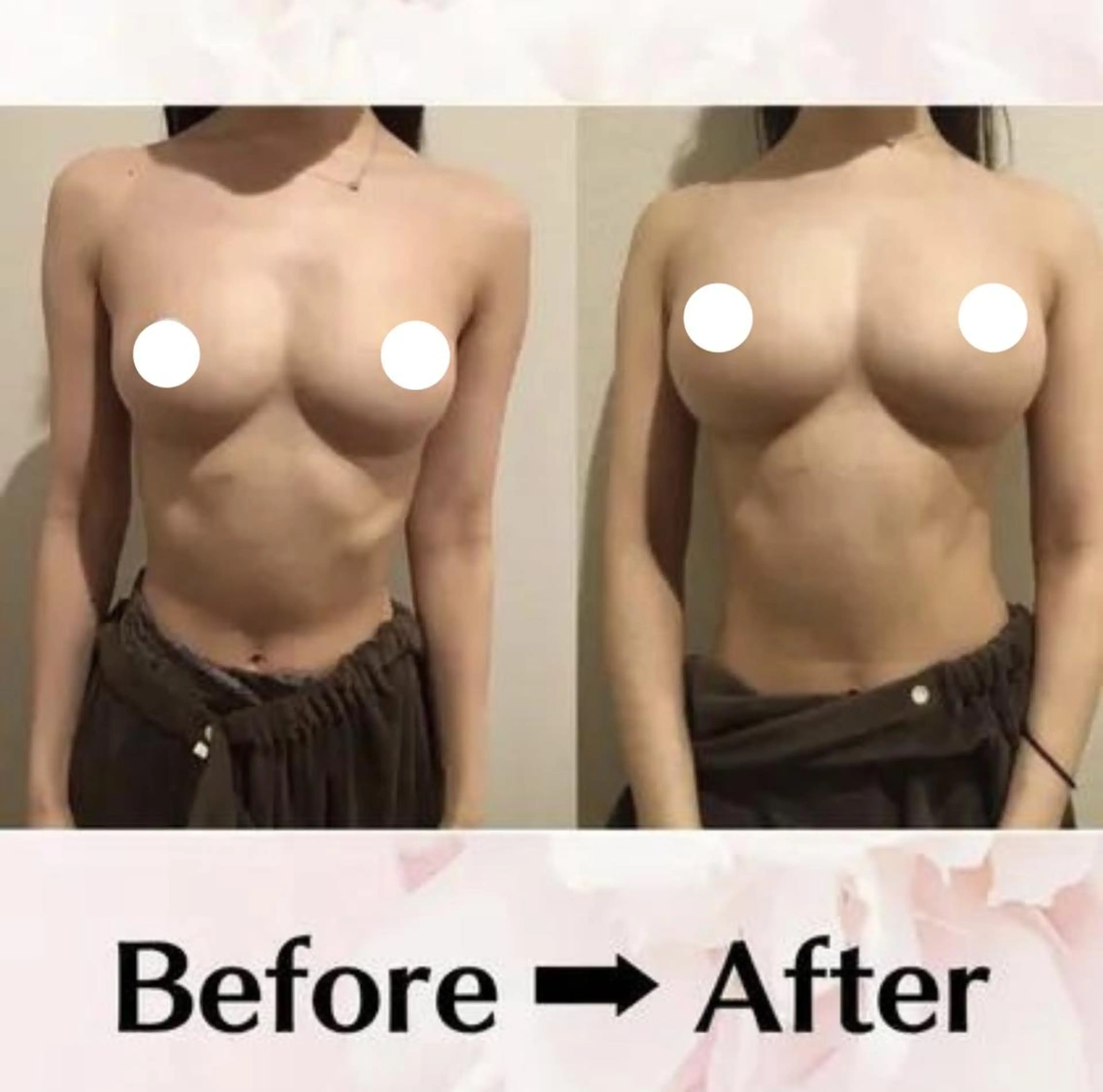 バスト・脱毛・痩身 上島のエステ・リラクイメージ