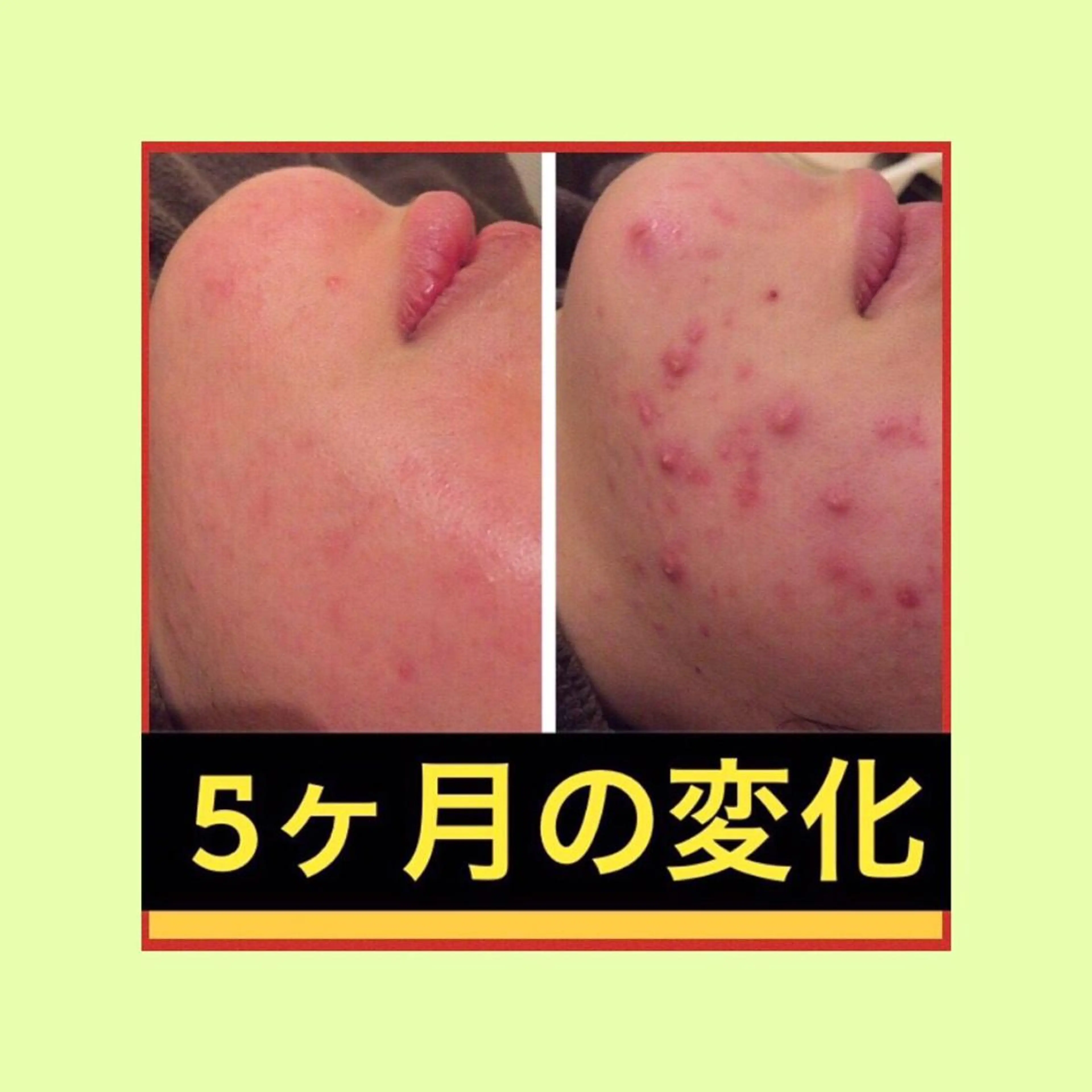 ミディアム パーマ ヘアアレンジ メンズ キッズ ネイル マツエク・マツパ ニキビ・肌質改善専門 ♡人生が変わるサロンのエステ・リラクイメージ