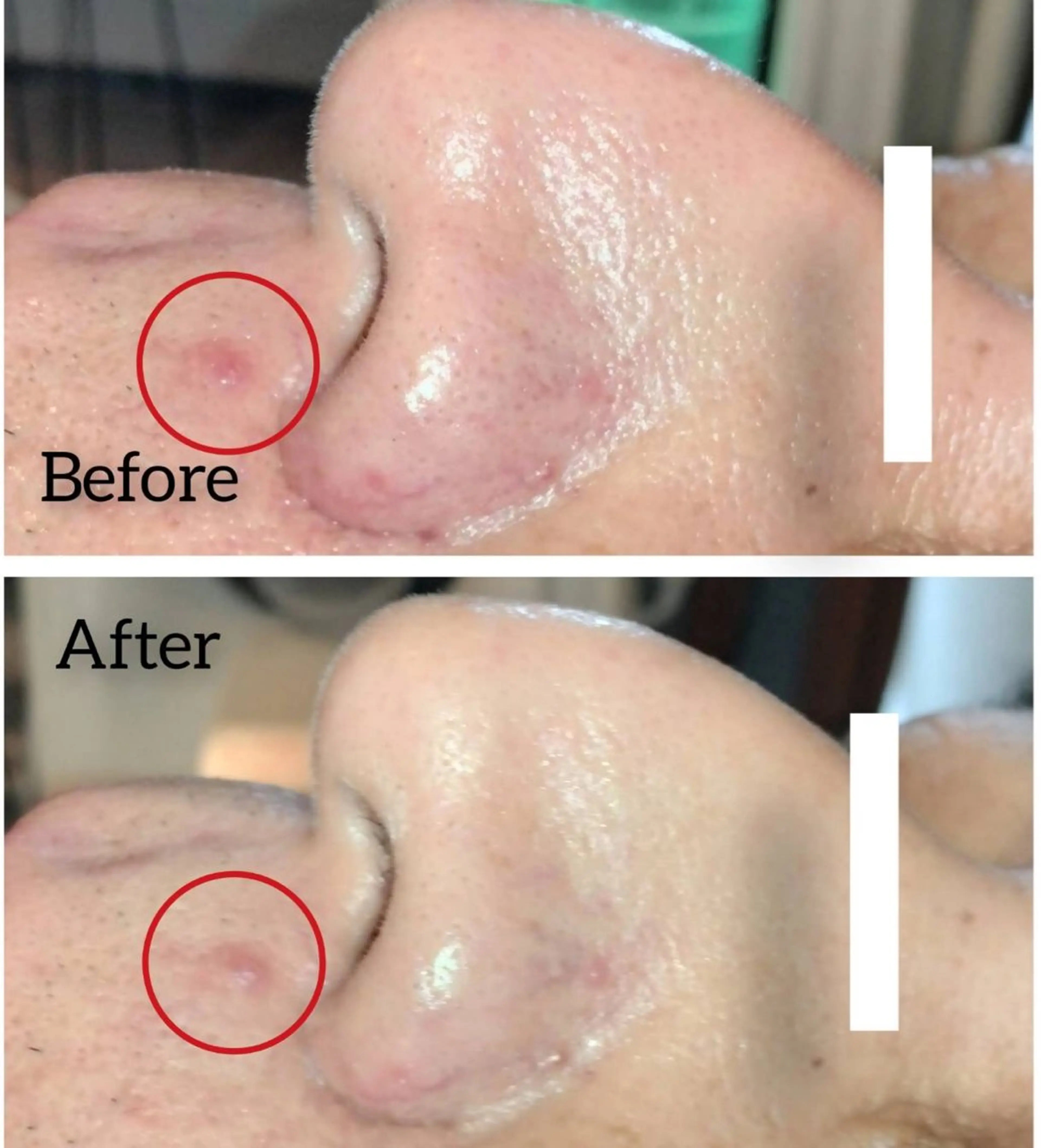 ポアレスサロン フィルのエステ・リラクイメージ