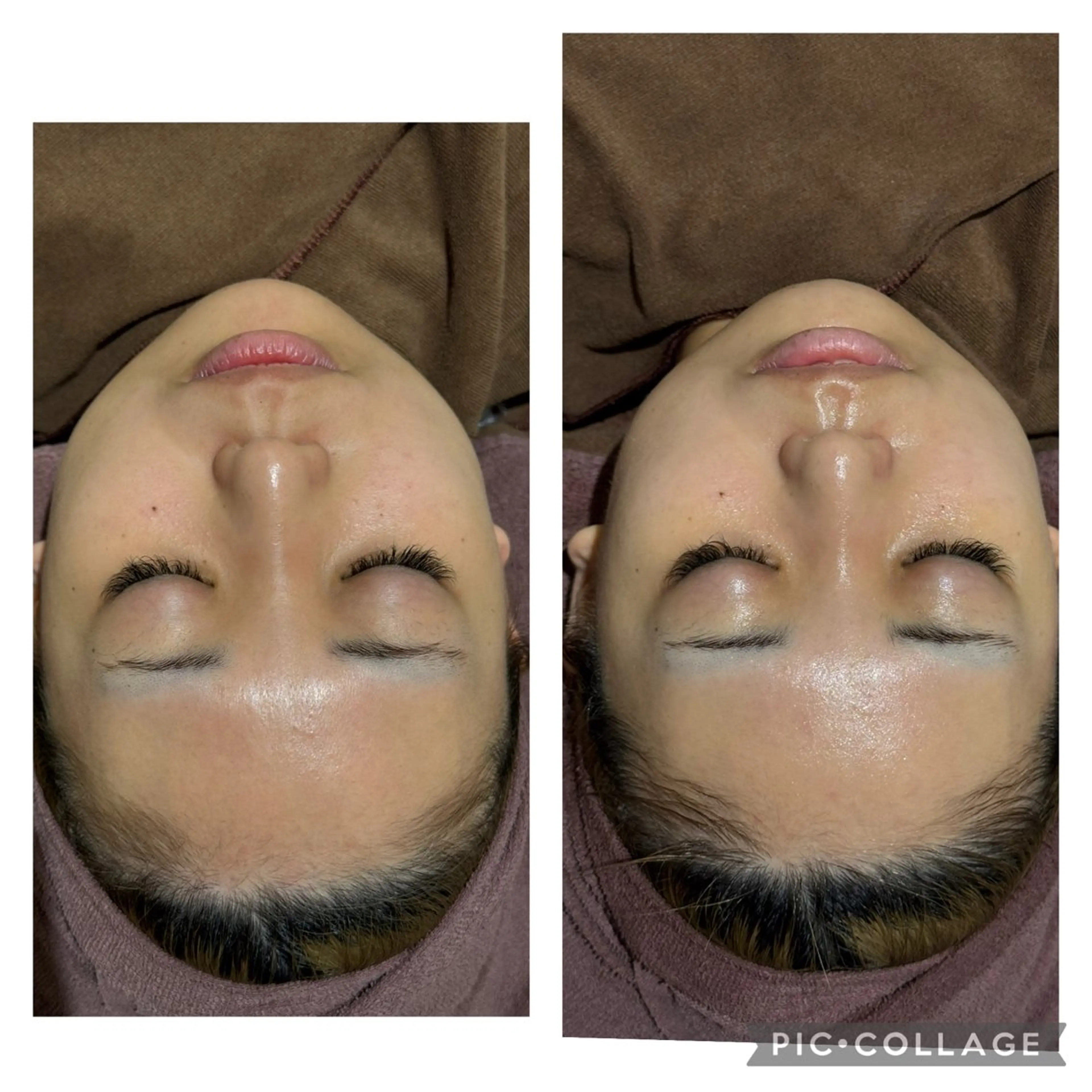 ニキビケア専門サロン Unityのエステ・リラクイメージ