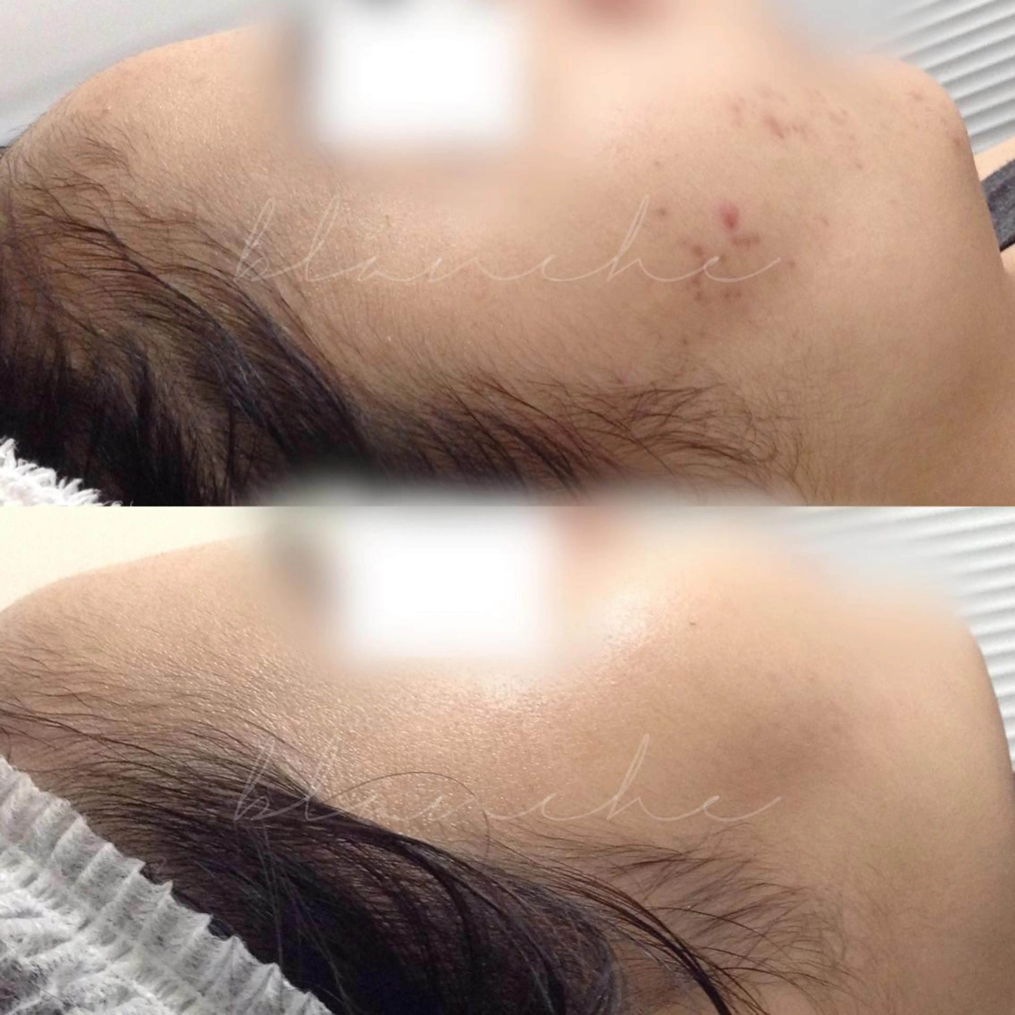 セミロング カラー パーマ ヘアアレンジ ネイル マツエク・マツパ アイブロウ エステ リラク 都度払い肌質改善 &脱毛Blancheのエステ・リラクイメージ