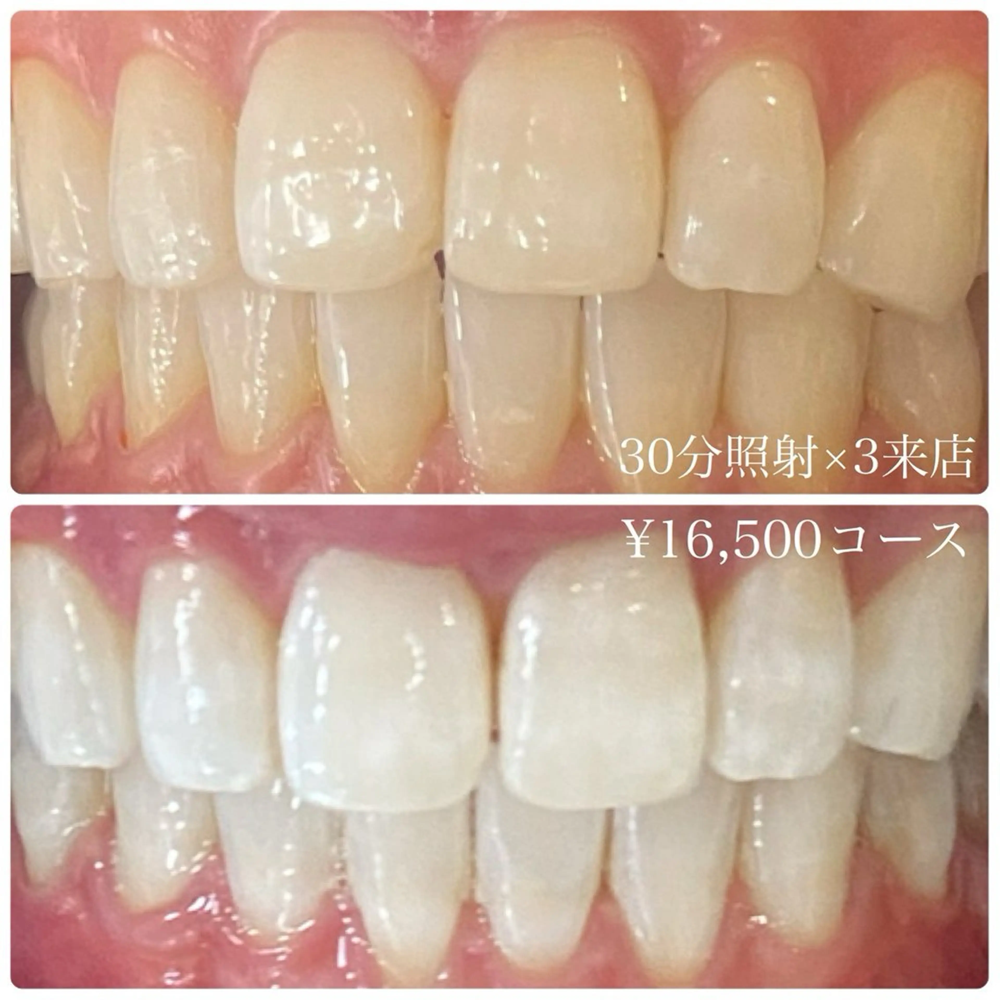 PLATINUM Beauty 横浜店所属・ホワイトニングルーム 横浜店のその他イメージ