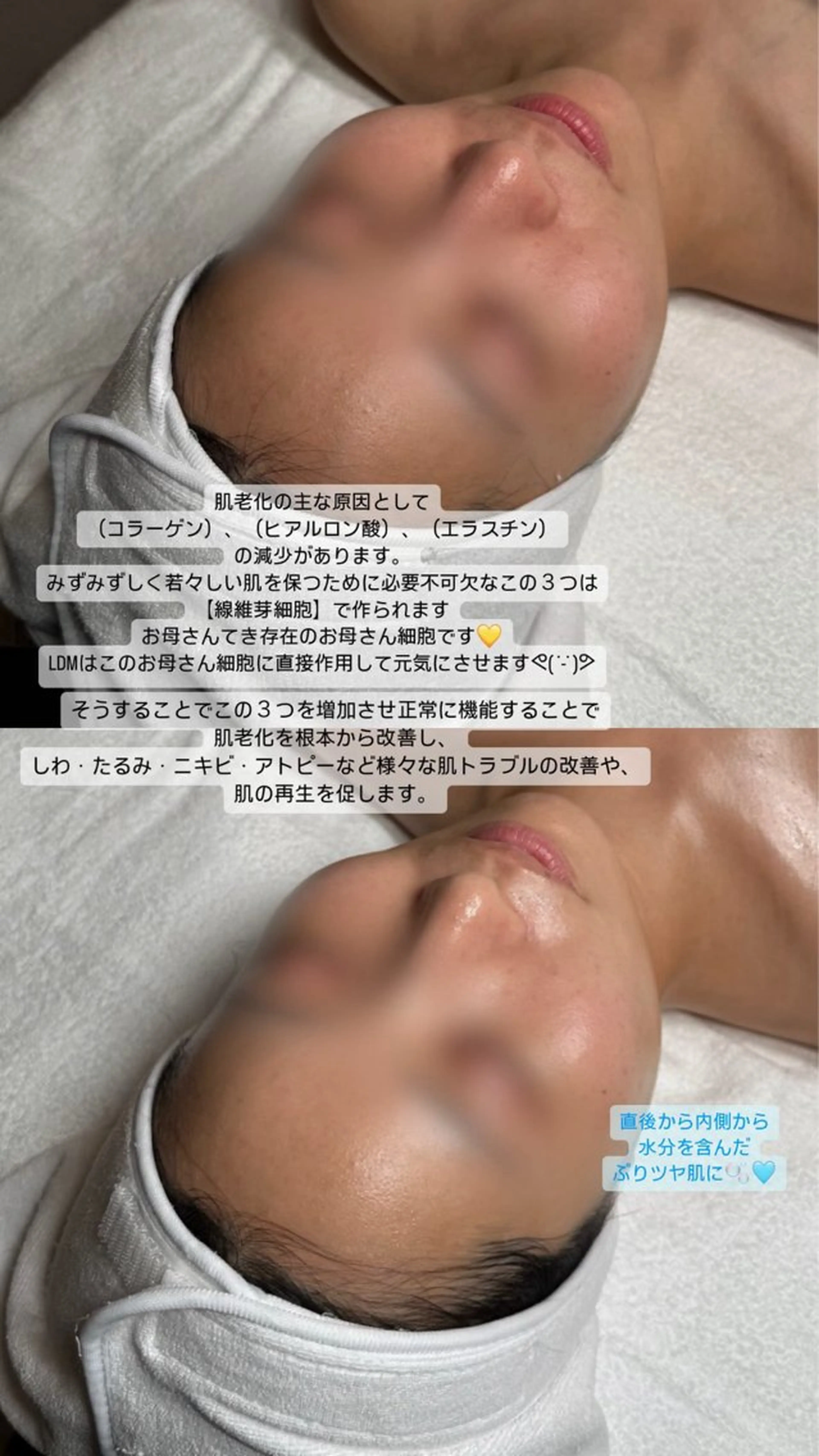 韓国肌管理🫧LDM 🫧Junnaのエステ・リラクイメージ