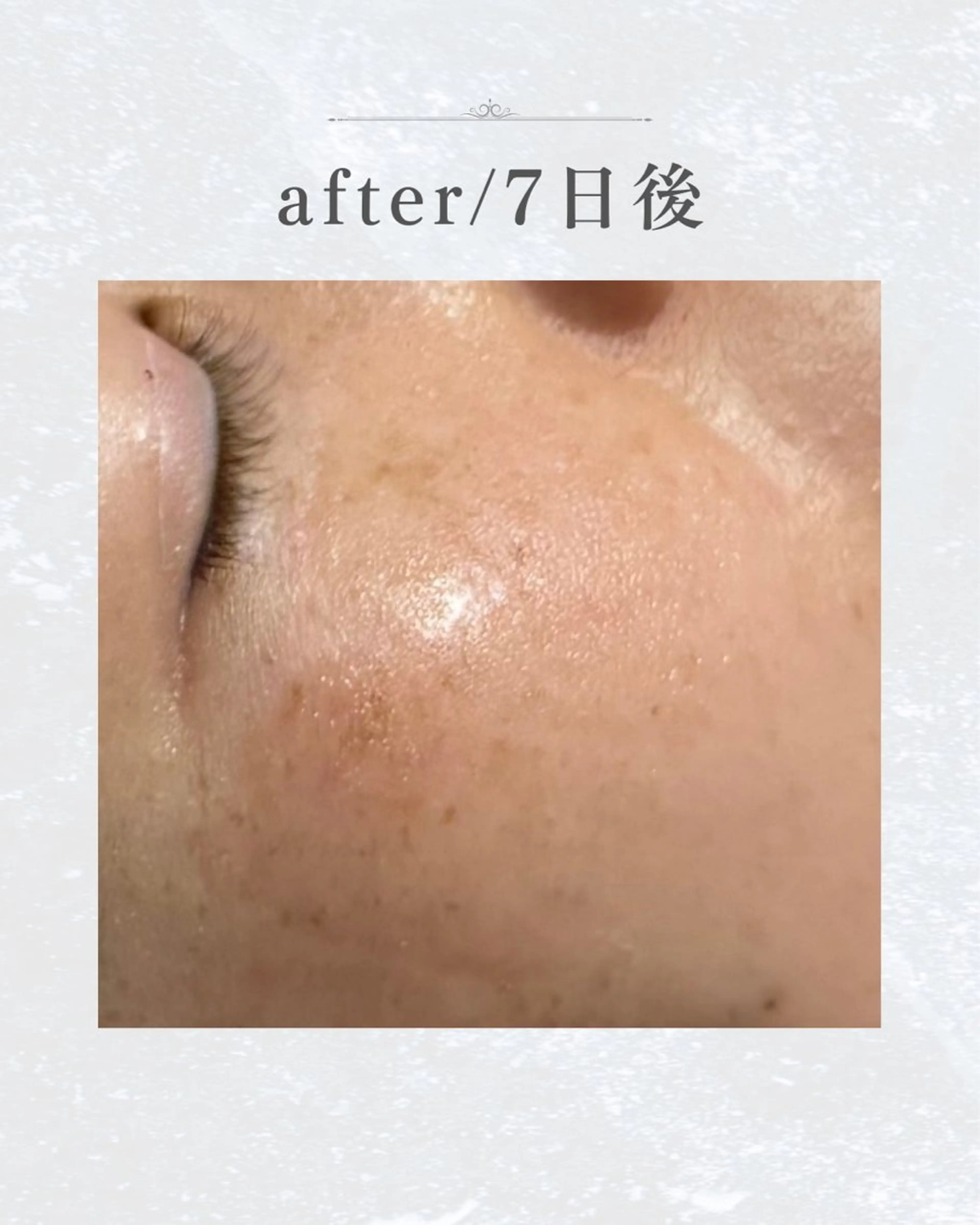 なにわのシミ取り職人 YUKIのエステ・リラクイメージ