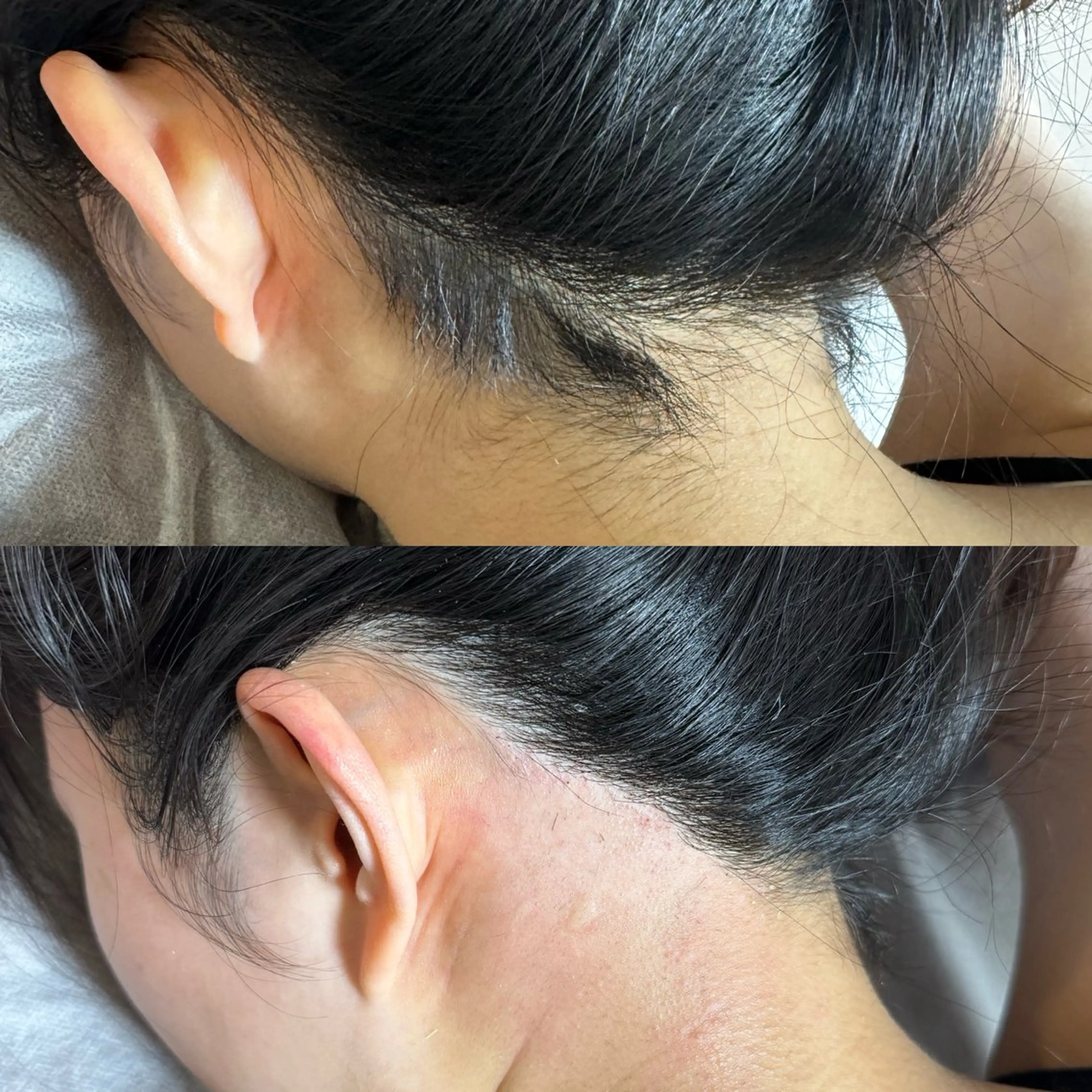 脱毛 六本木脱毛andS 店長Sachiのエステ・リラクイメージ