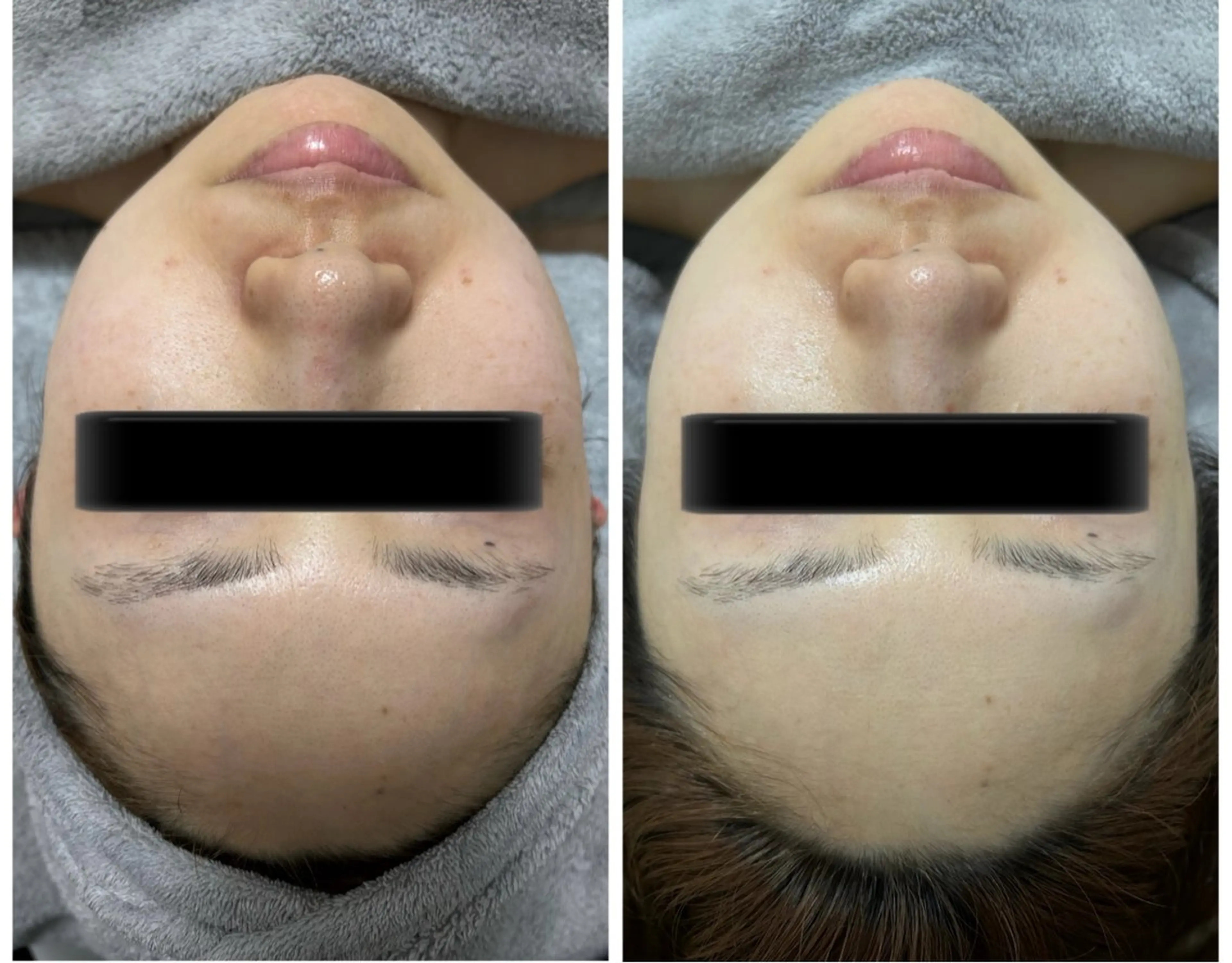 エステ esthesalon Ran所属・小顔美肌痩身サロン Ranのその他イメージ