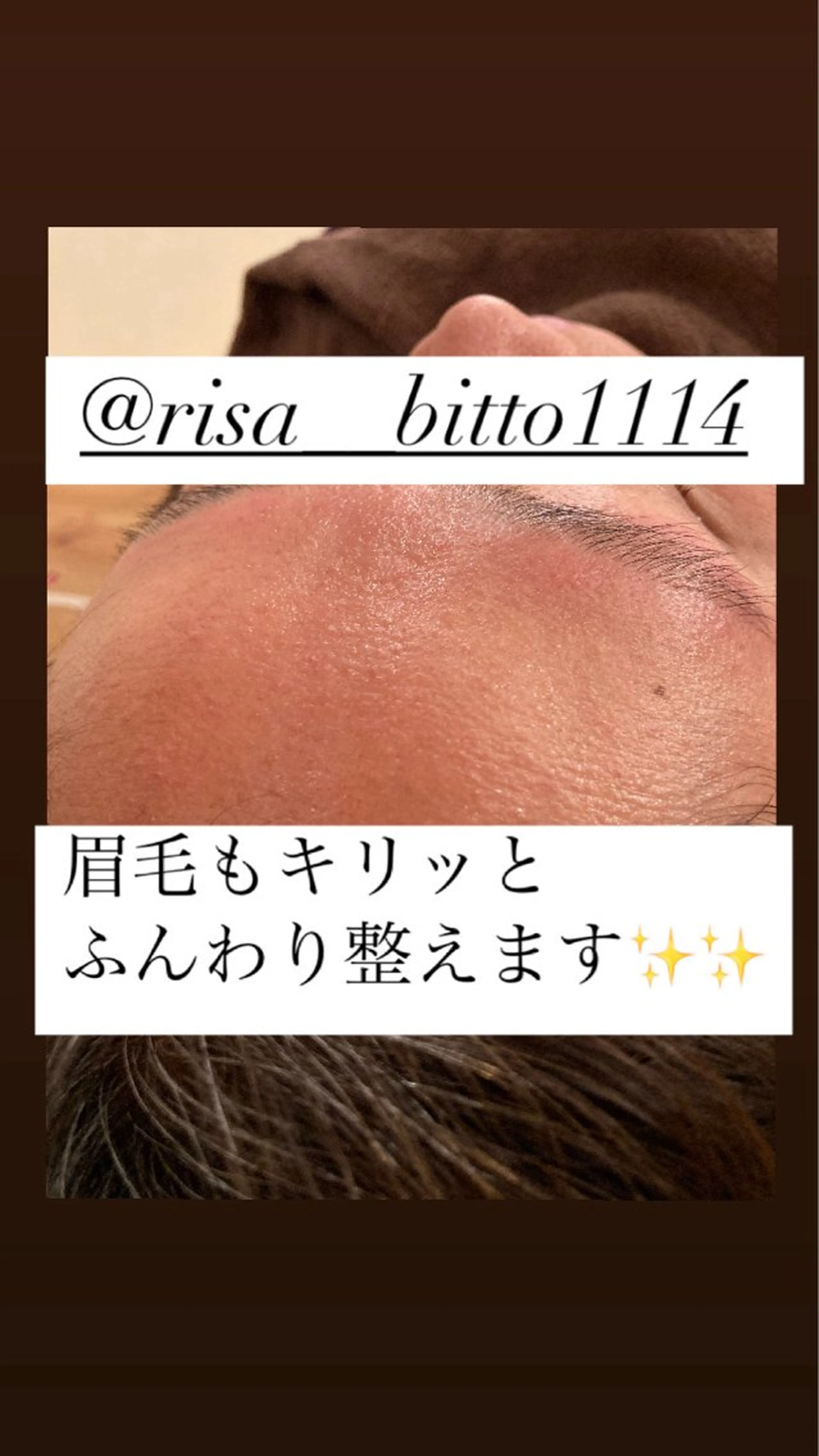 エステ 産毛専門店 Bittoのエステ・リラクイメージ