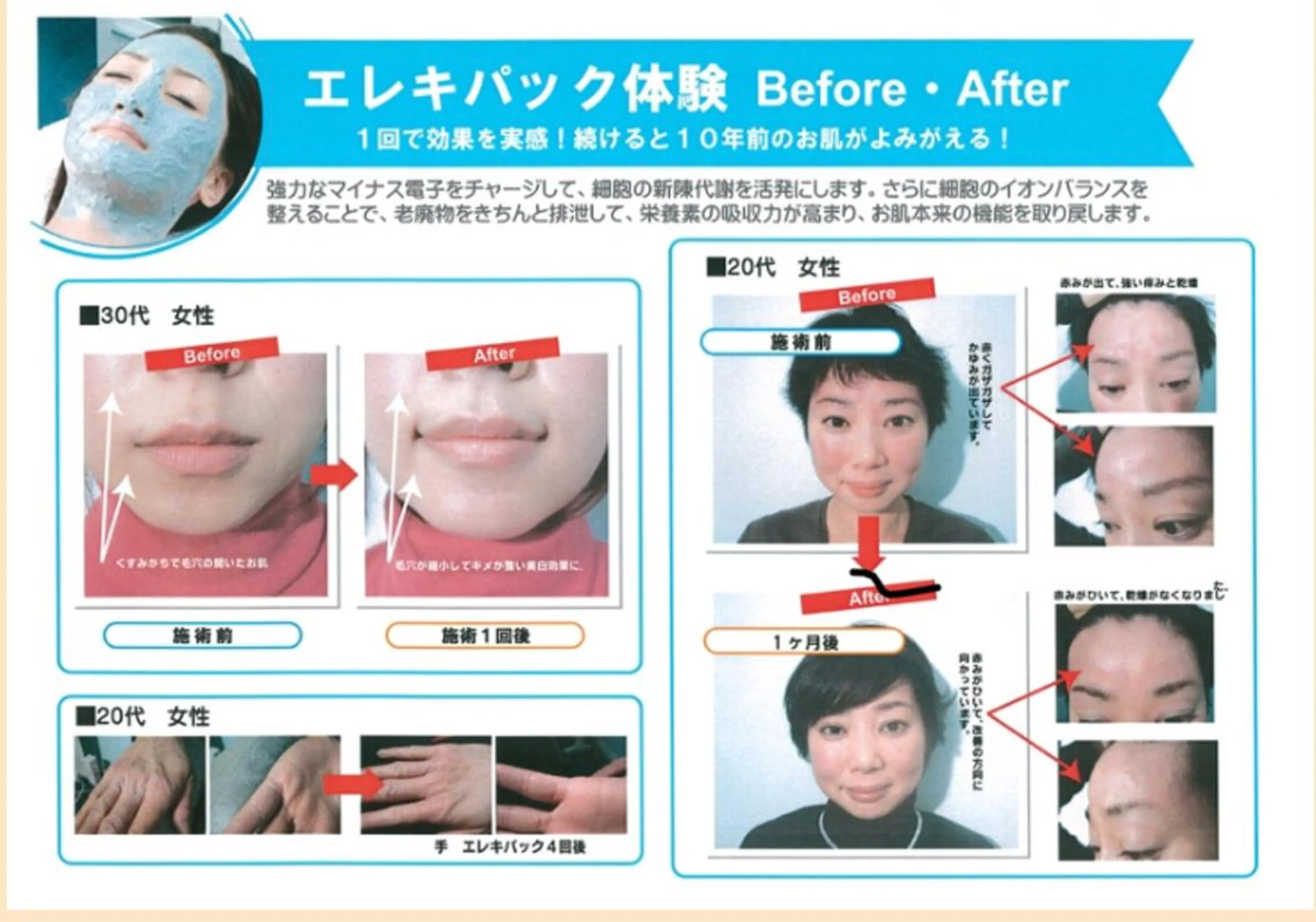 初めての方限定！驚異の力！ビリビリエレキパックコース！の写真