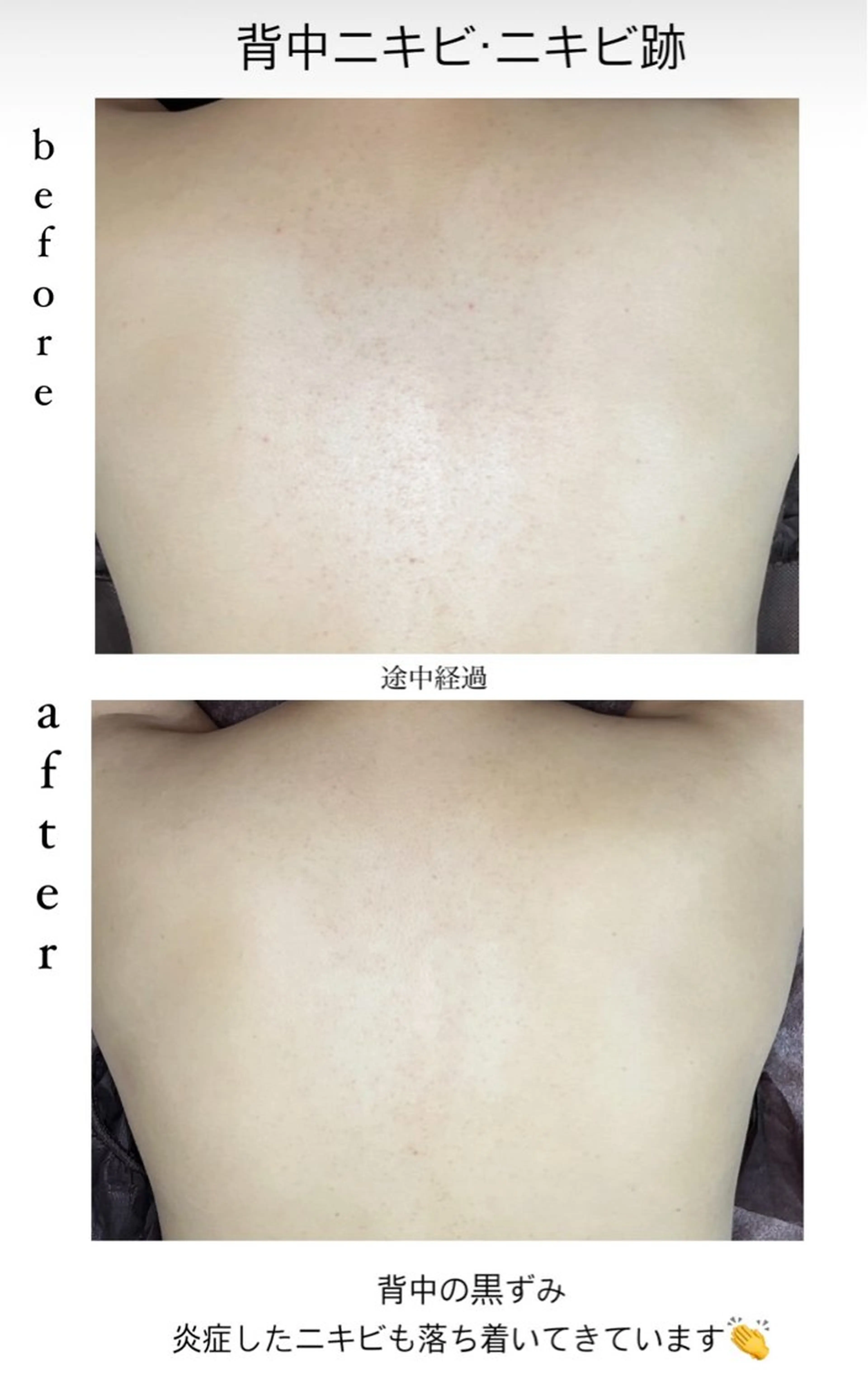 エステ ベラージュ【美背中・ 美尻・フェイシャル】のエステ・リラクイメージ