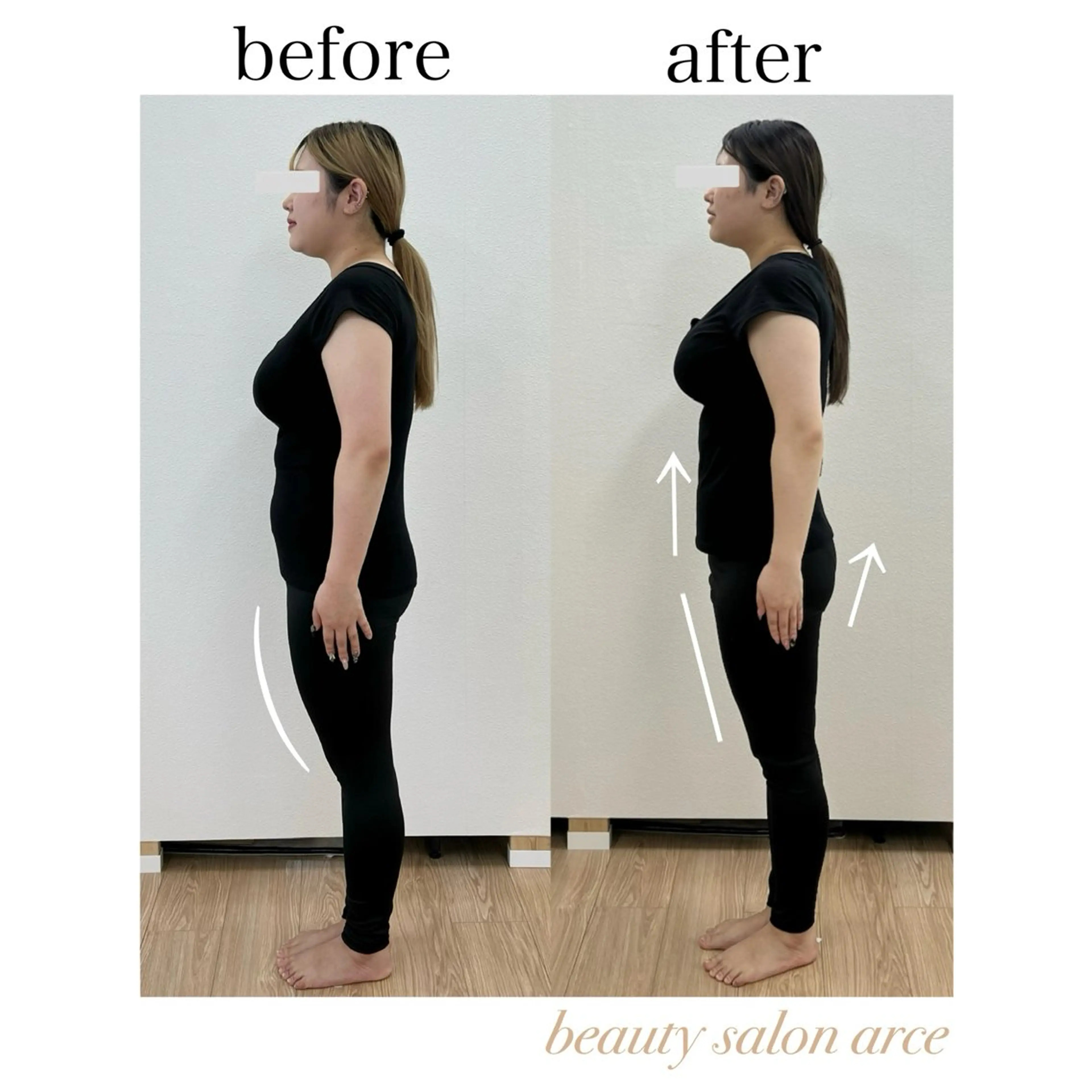 "今だけ半額"【スタンダード｜全身美容矯正】　小顔矯正＋姿勢矯正。つま先から頭の先まで全身しっかり矯正！の写真