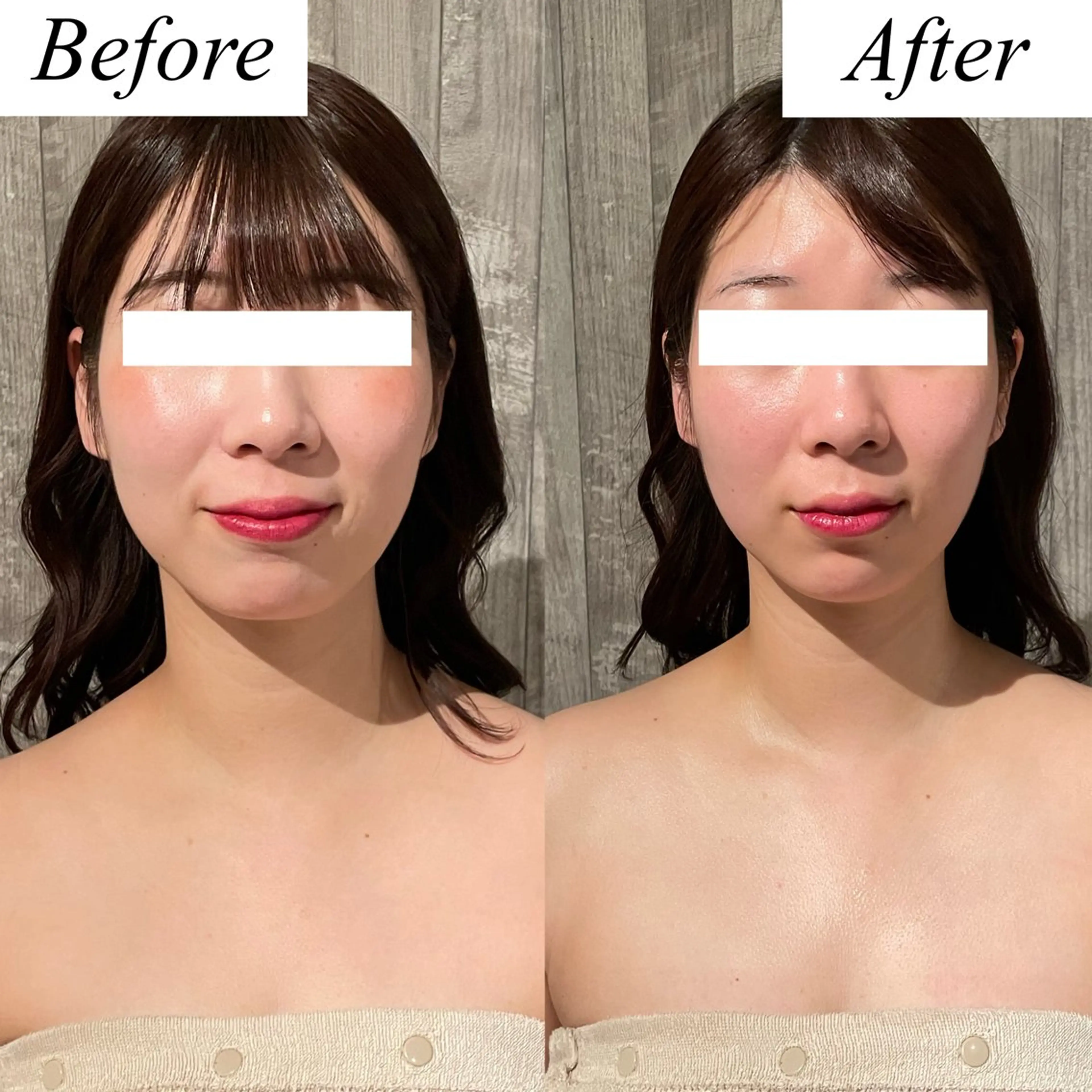 グレースフィオーレ上野御徒町店所属・頭蓋骨小顔矯正 上野御徒町店＊かんなのエステ・リラクイメージ