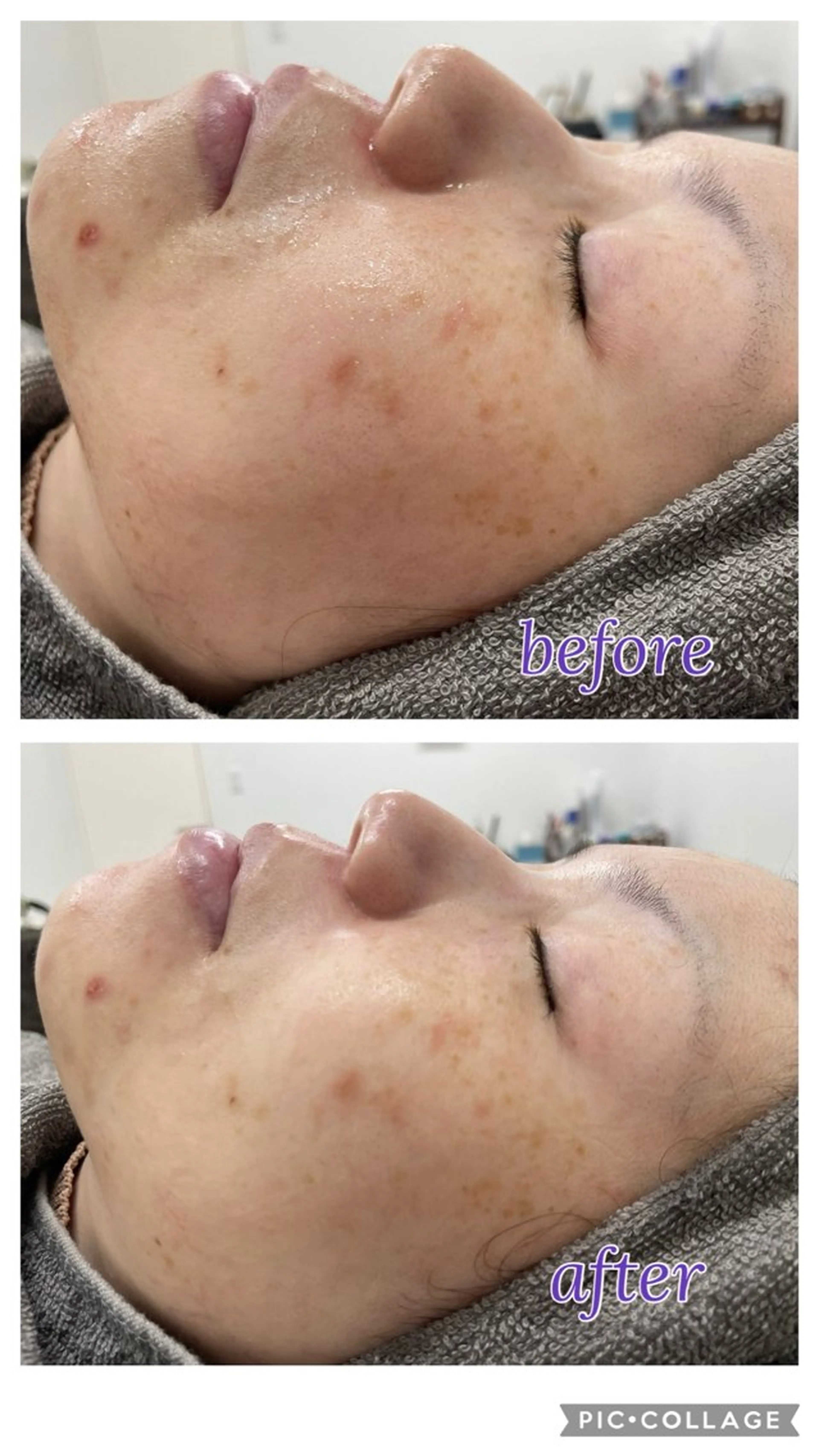 撮影モデル total beauty  salon RIRE所属・古川 弥生のエステ・リラクイメージ