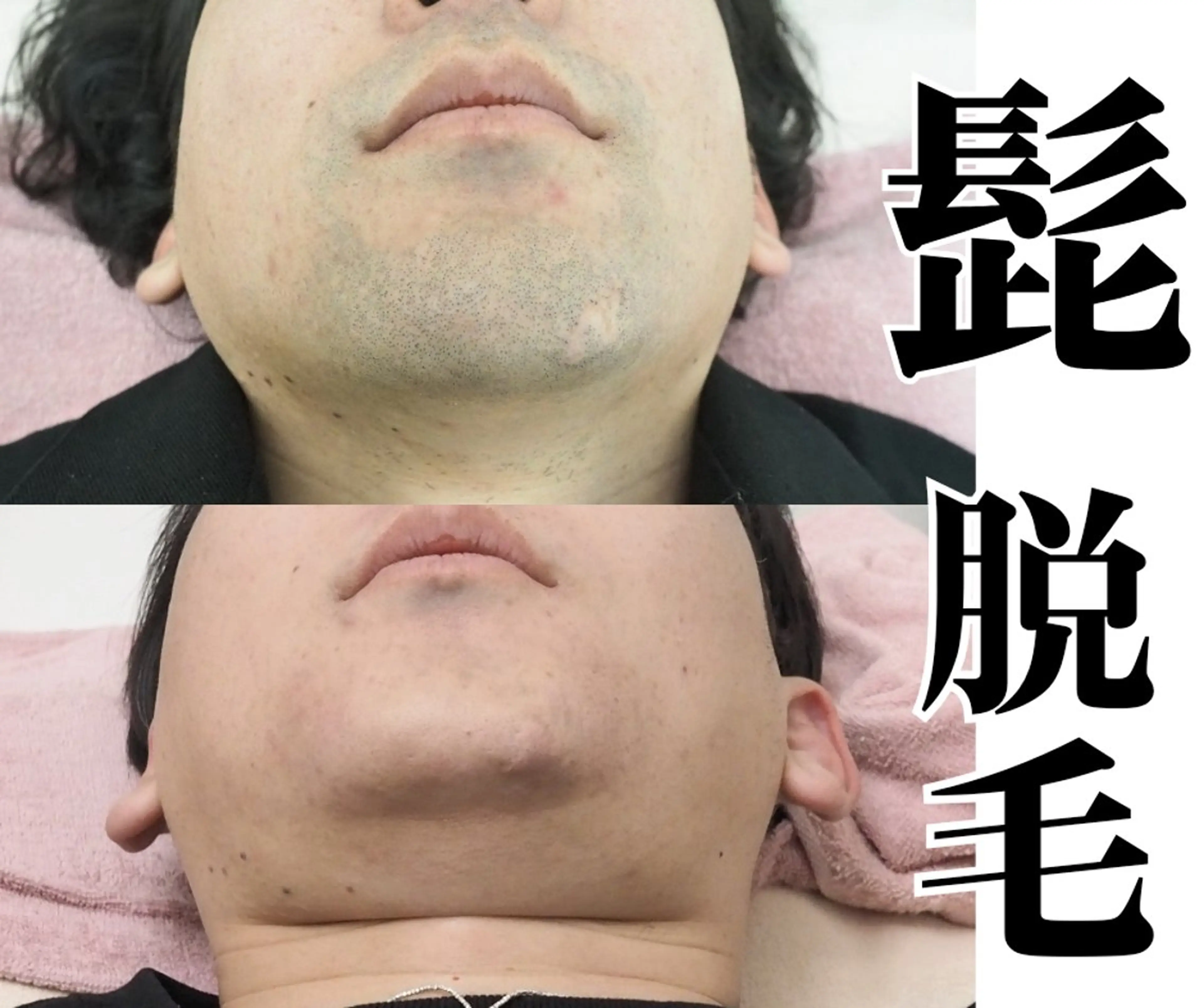 メンズ ユニセックスエステサロンUniclear所属・痩身&フェイシャル Uniclearのエステ・リラクイメージ