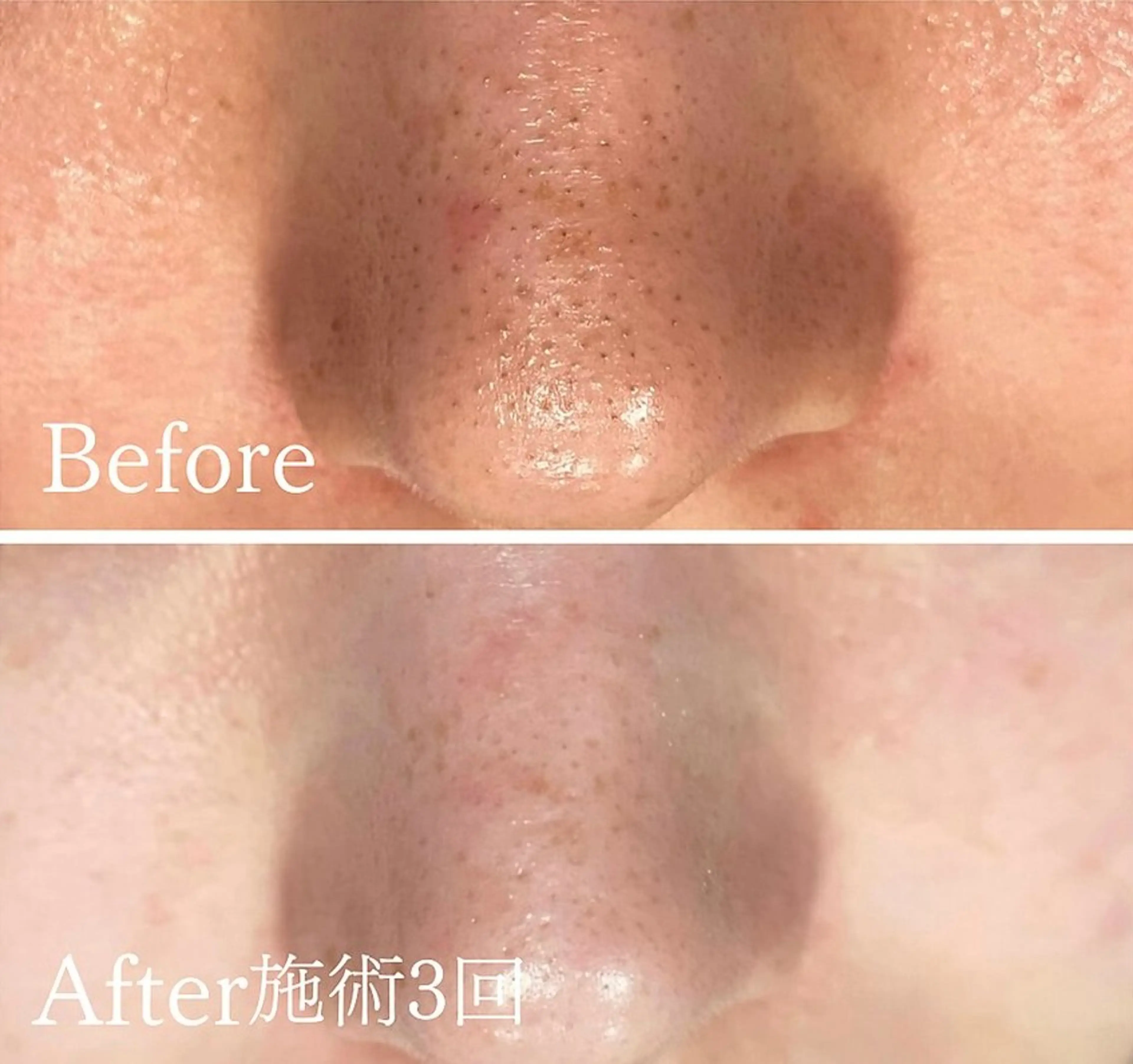 アンド ミルルのエステ・リラクイメージ