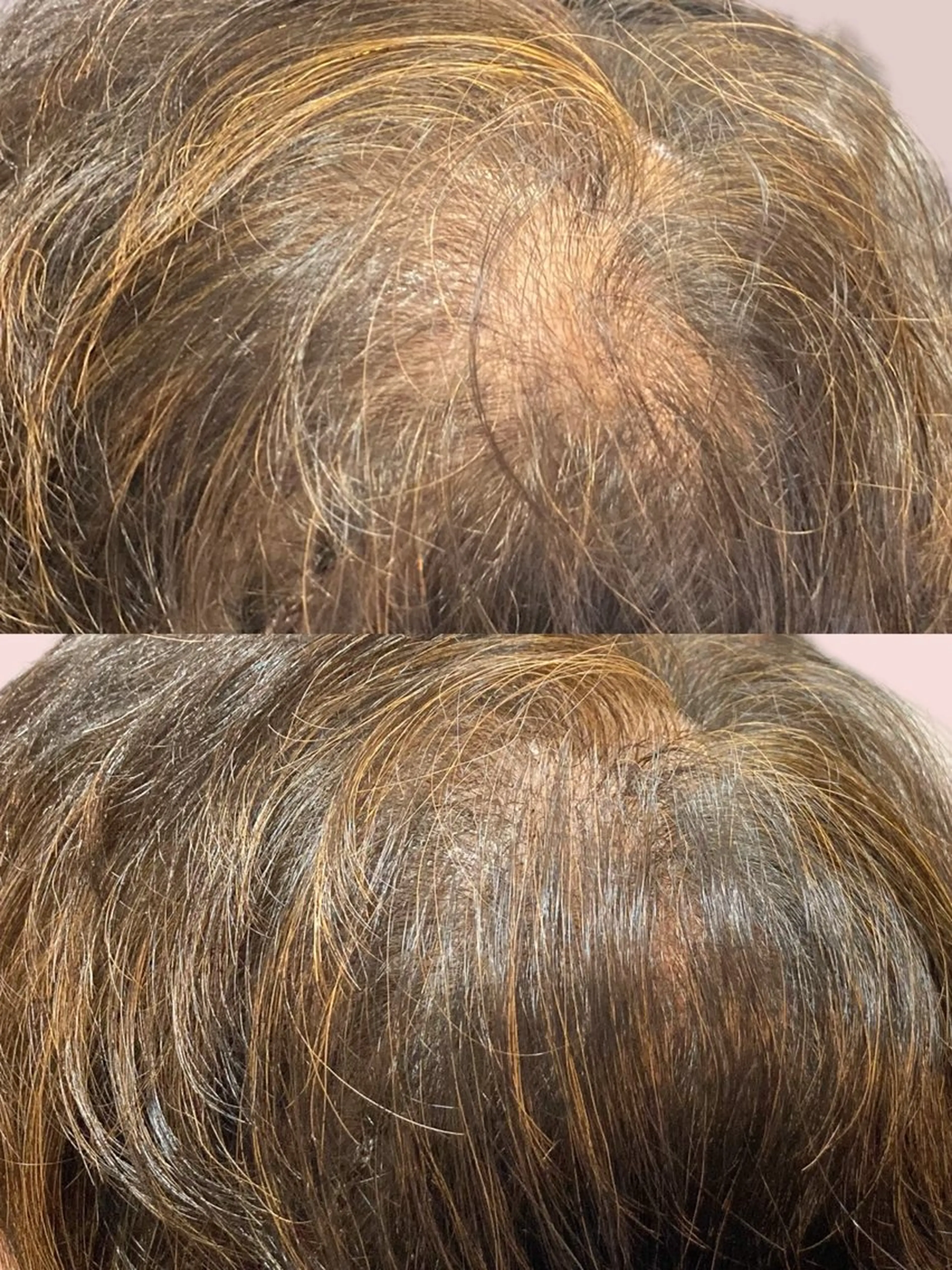 エクステ 25ニコ所属・25 ニコのヘアスタイル