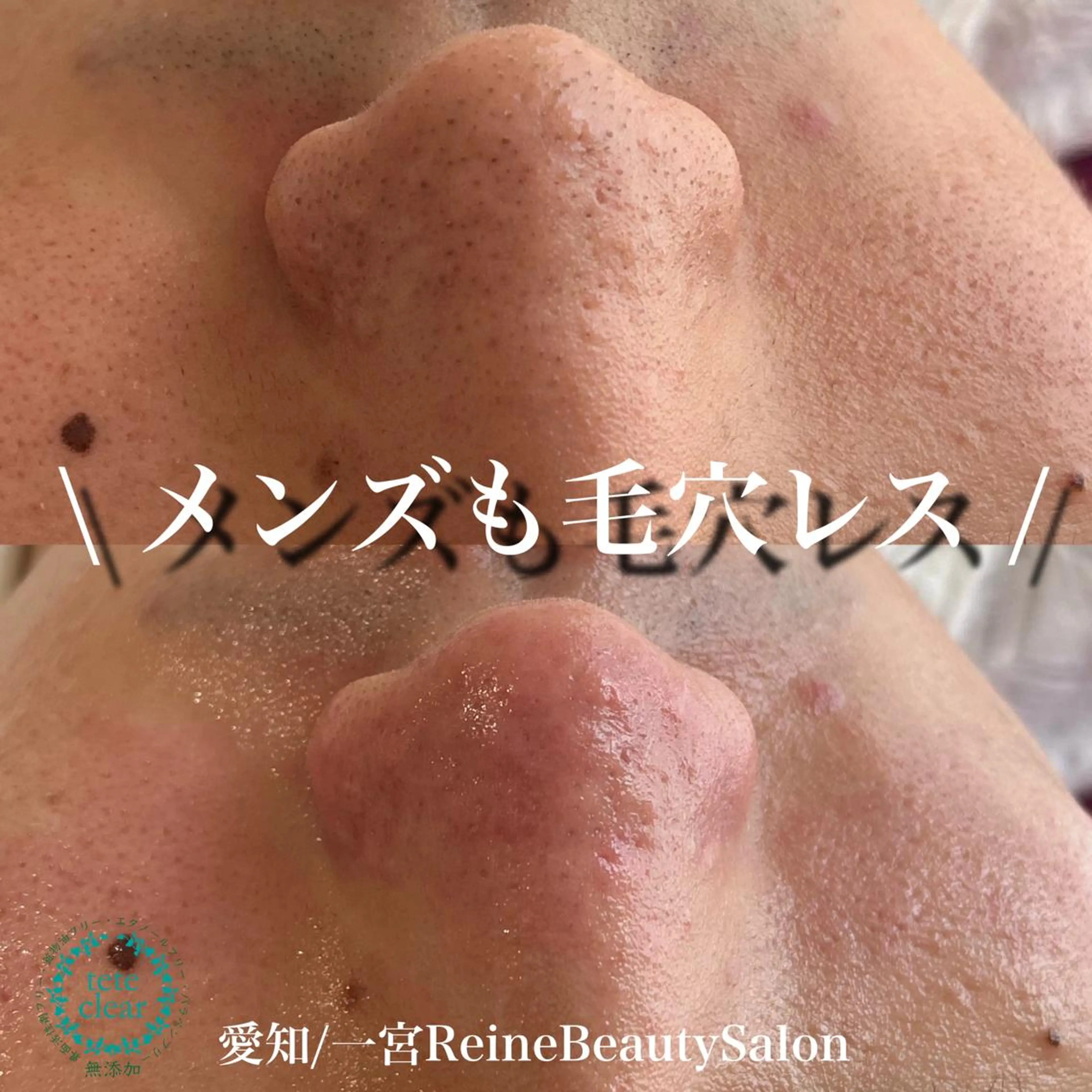 エステ Reine BeautySalon所属・毛穴/シミ肝斑/脱毛 横山梨里のエステ・リラクイメージ