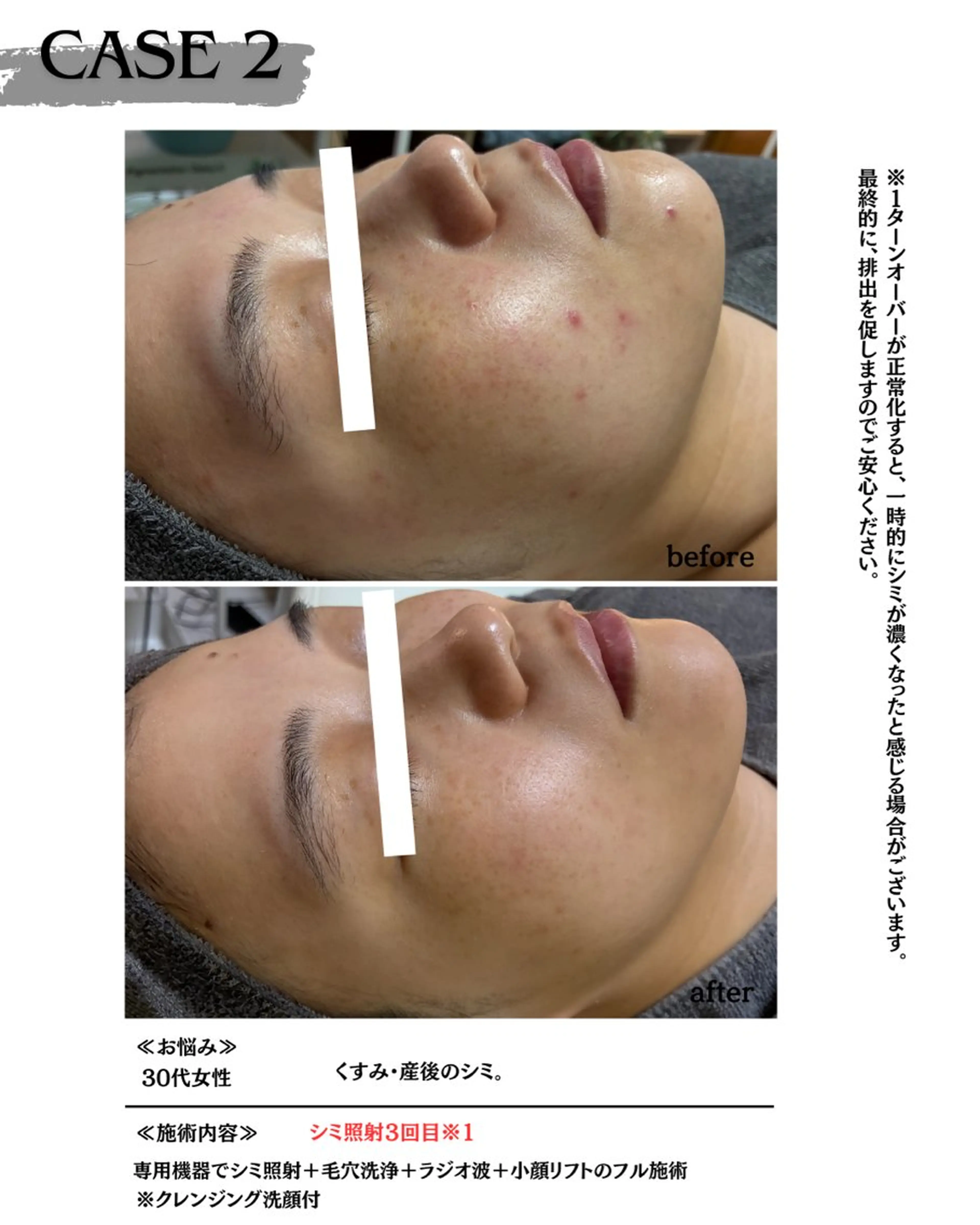 エステ 素肌育成・シミケア専門サロン美潤-miulu-所属・【医療提携サロン】 【シミケア専門】のエステ・リラクイメージ