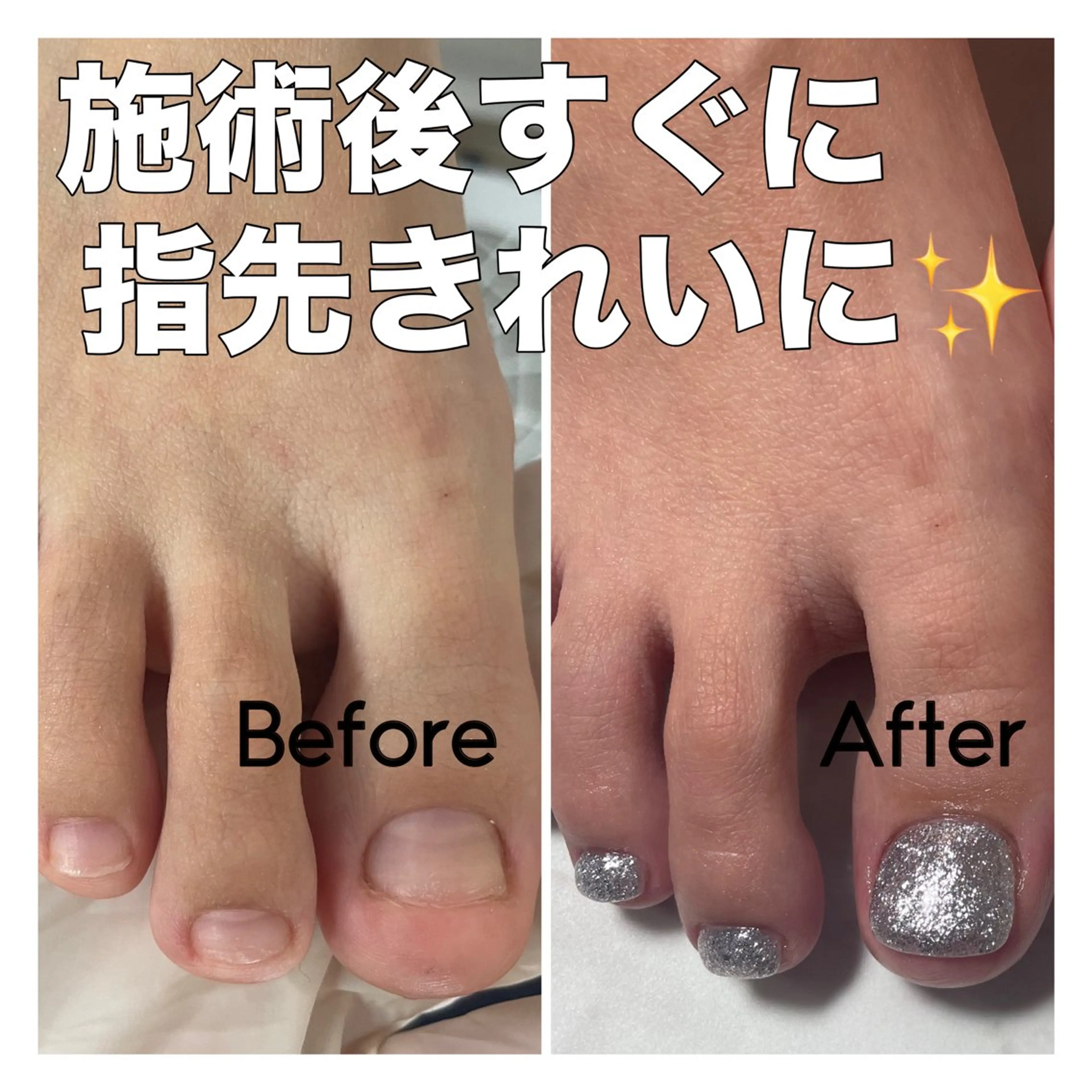 ネイル フットネイル petillant所属・nail salon petillantのネイルデザイン