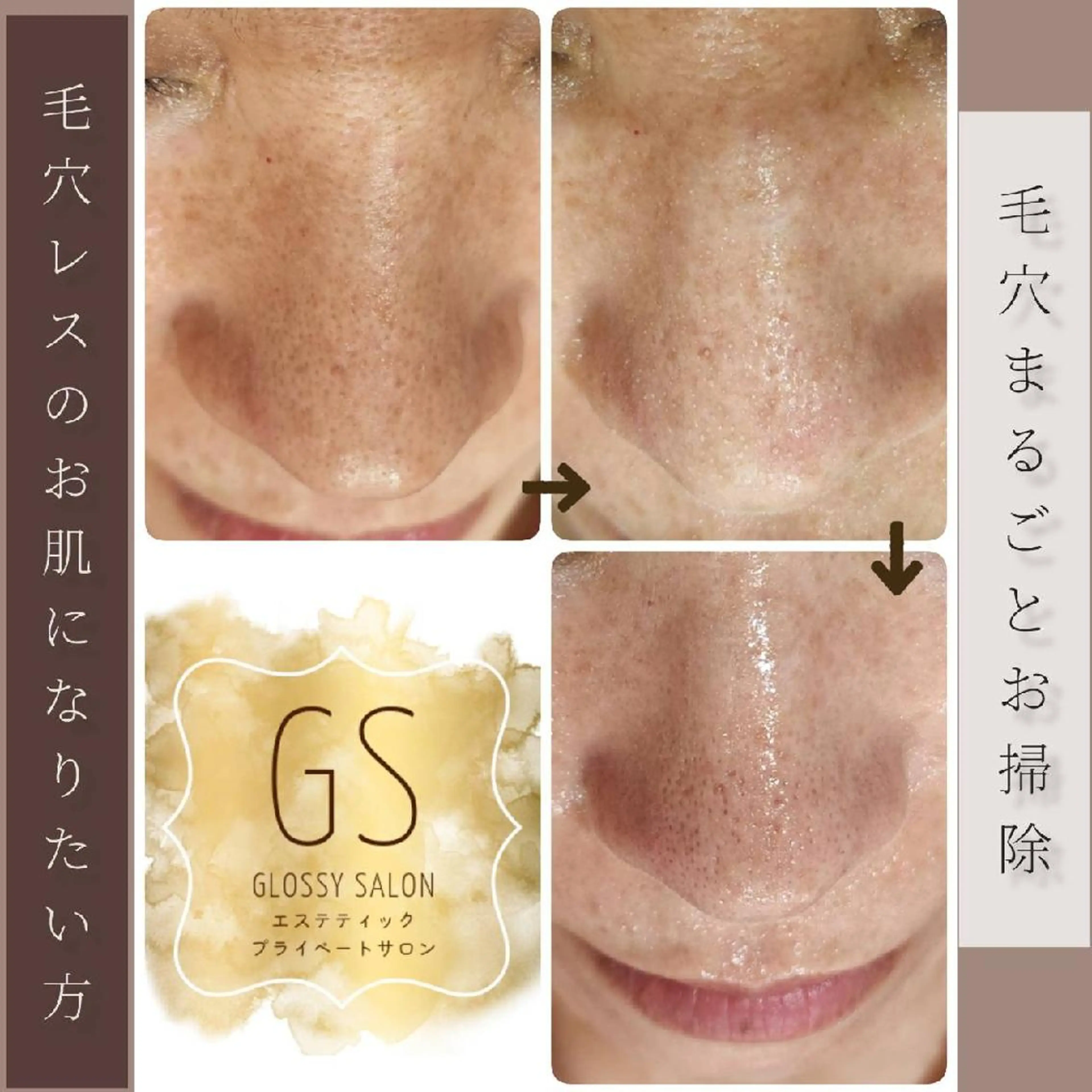 エステ リラク Glossy salonのエステ・リラクイメージ