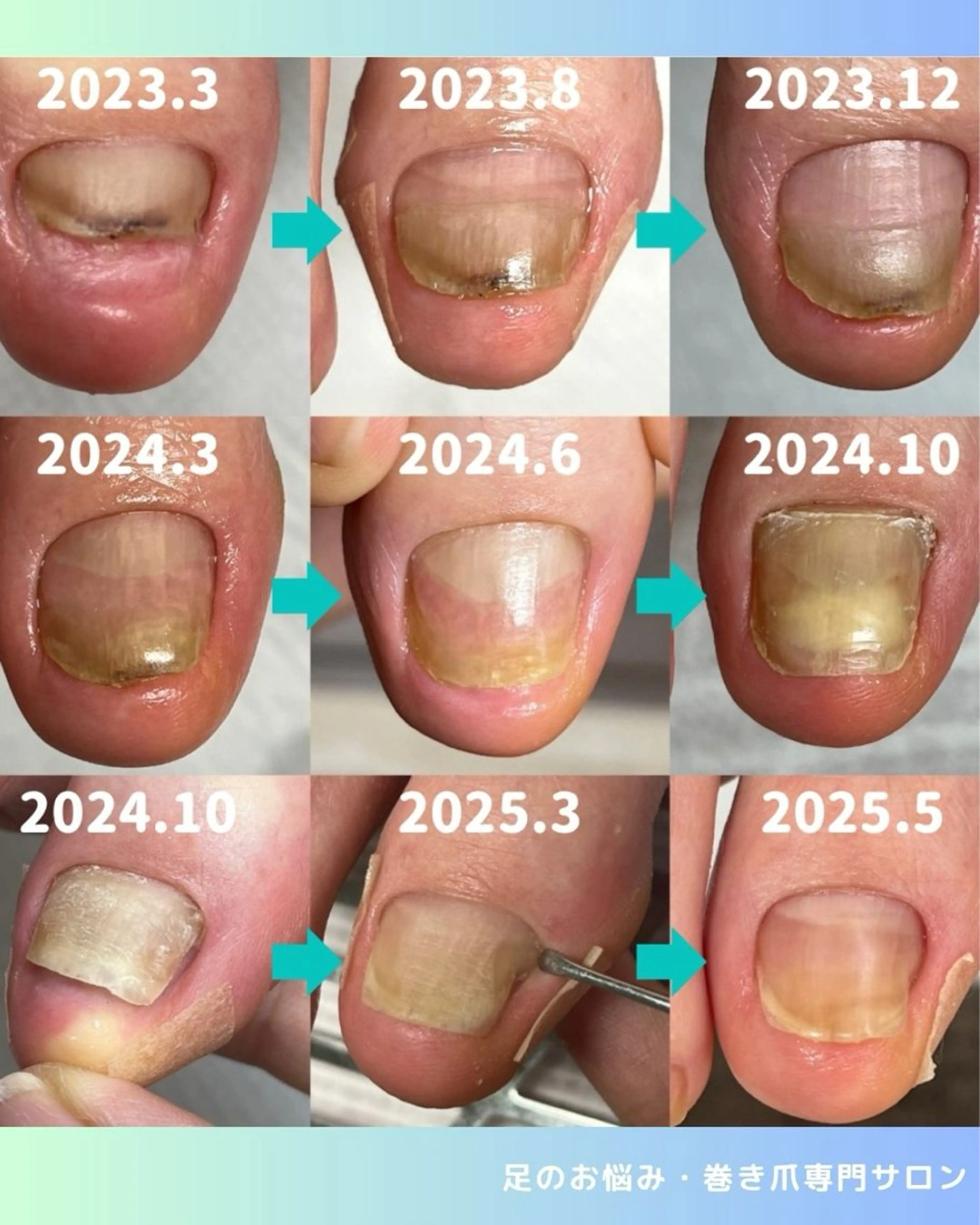 ネイル フットネイル rangrang nailのネイルデザイン